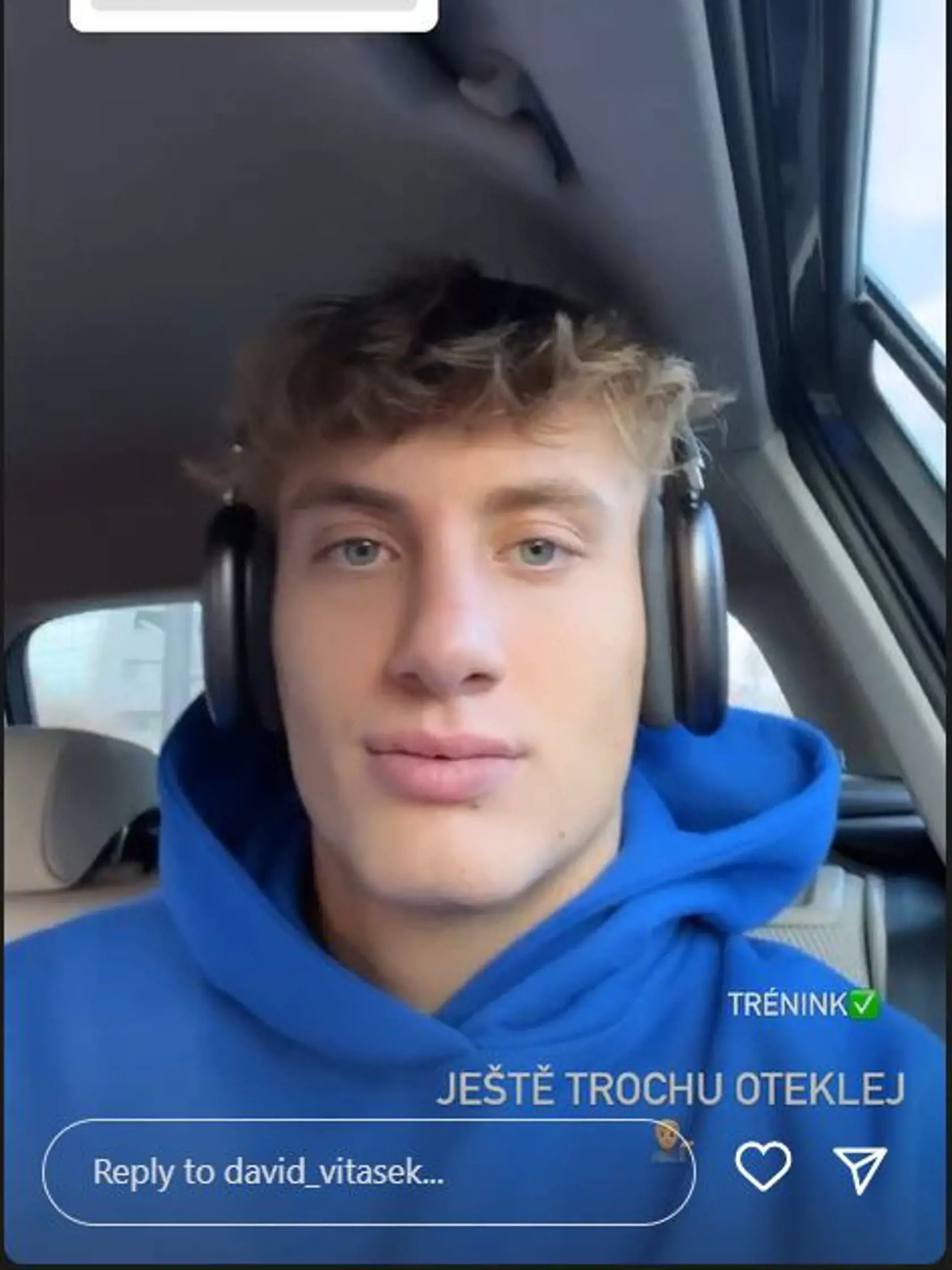 David z Love Island má za sebou rhinoplastiku. Takto vyzerá po zložení dlahy.