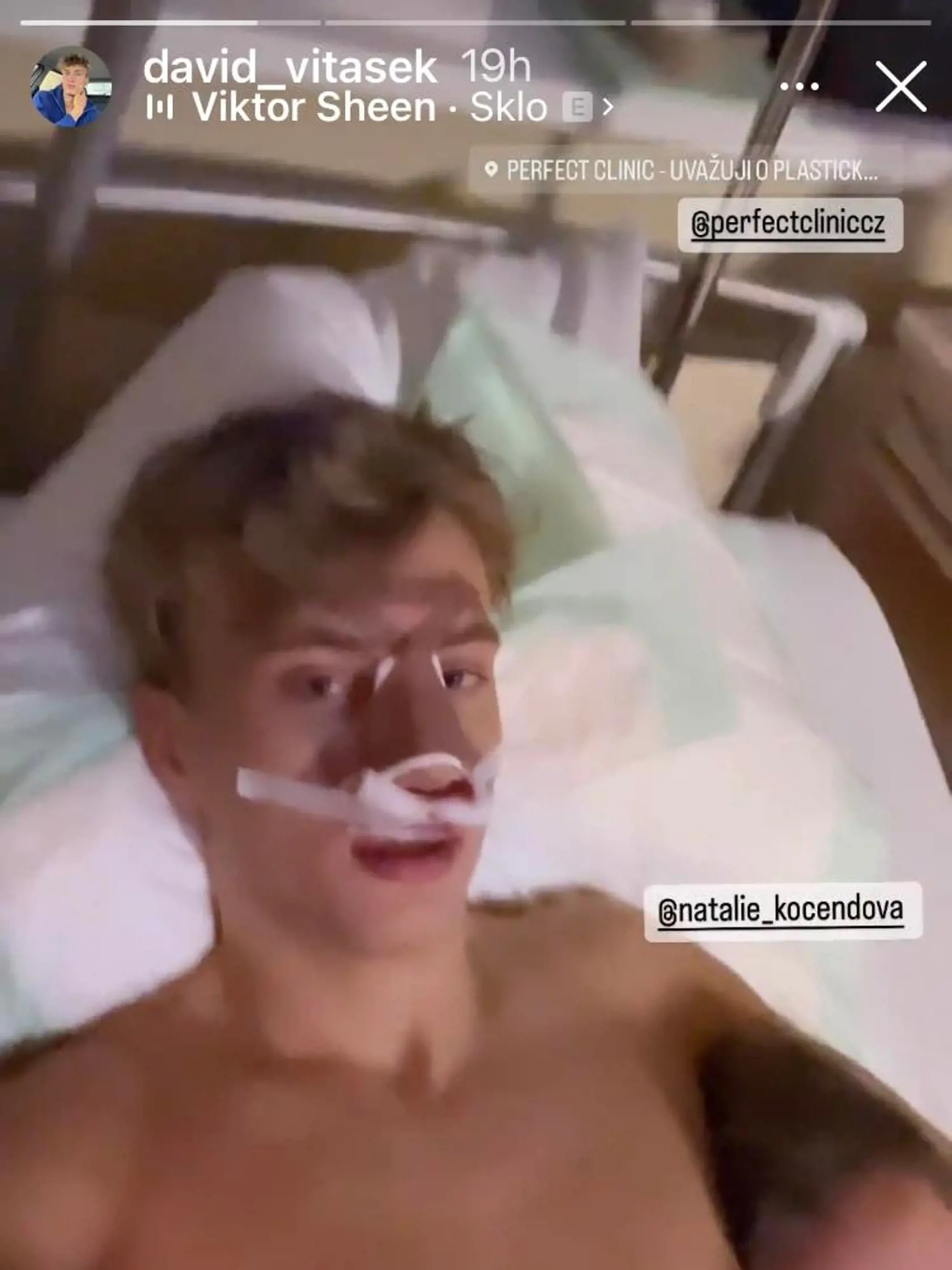 David ukázal fotku po operácii nosa.