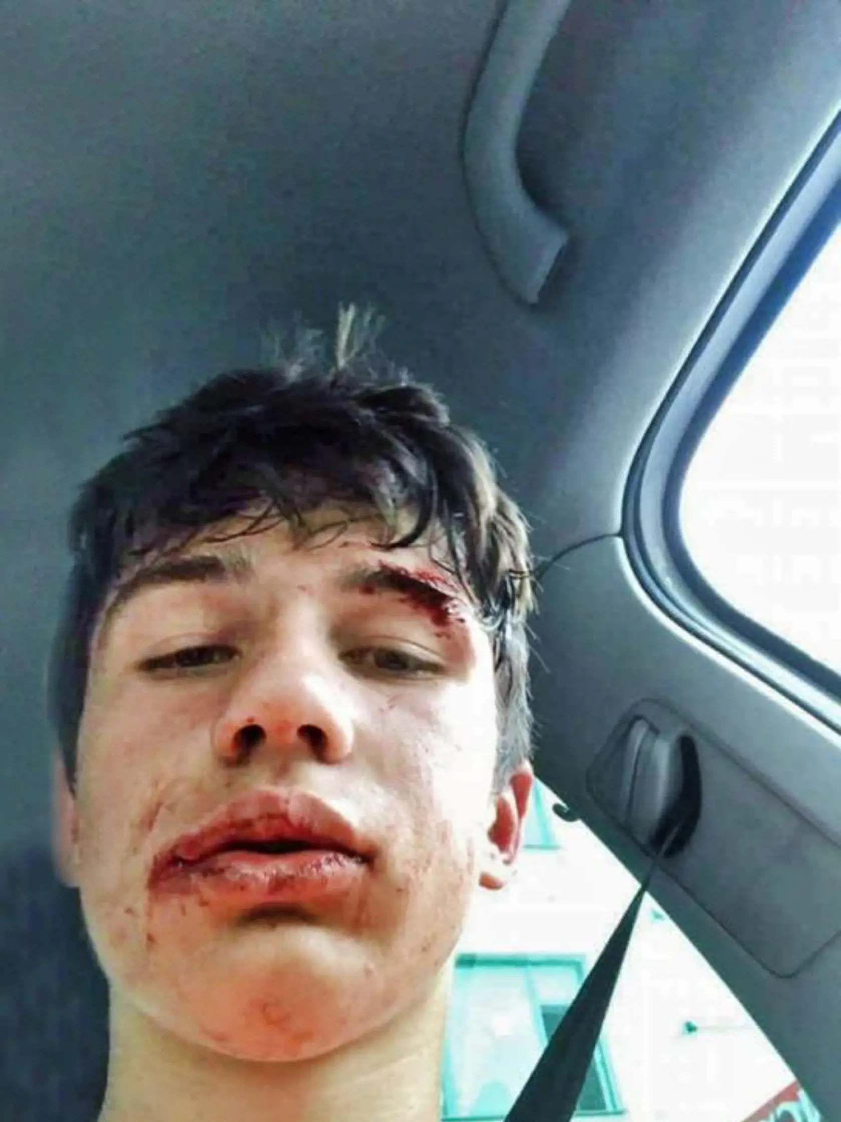Alex si spravil selfie tesne po bitke.