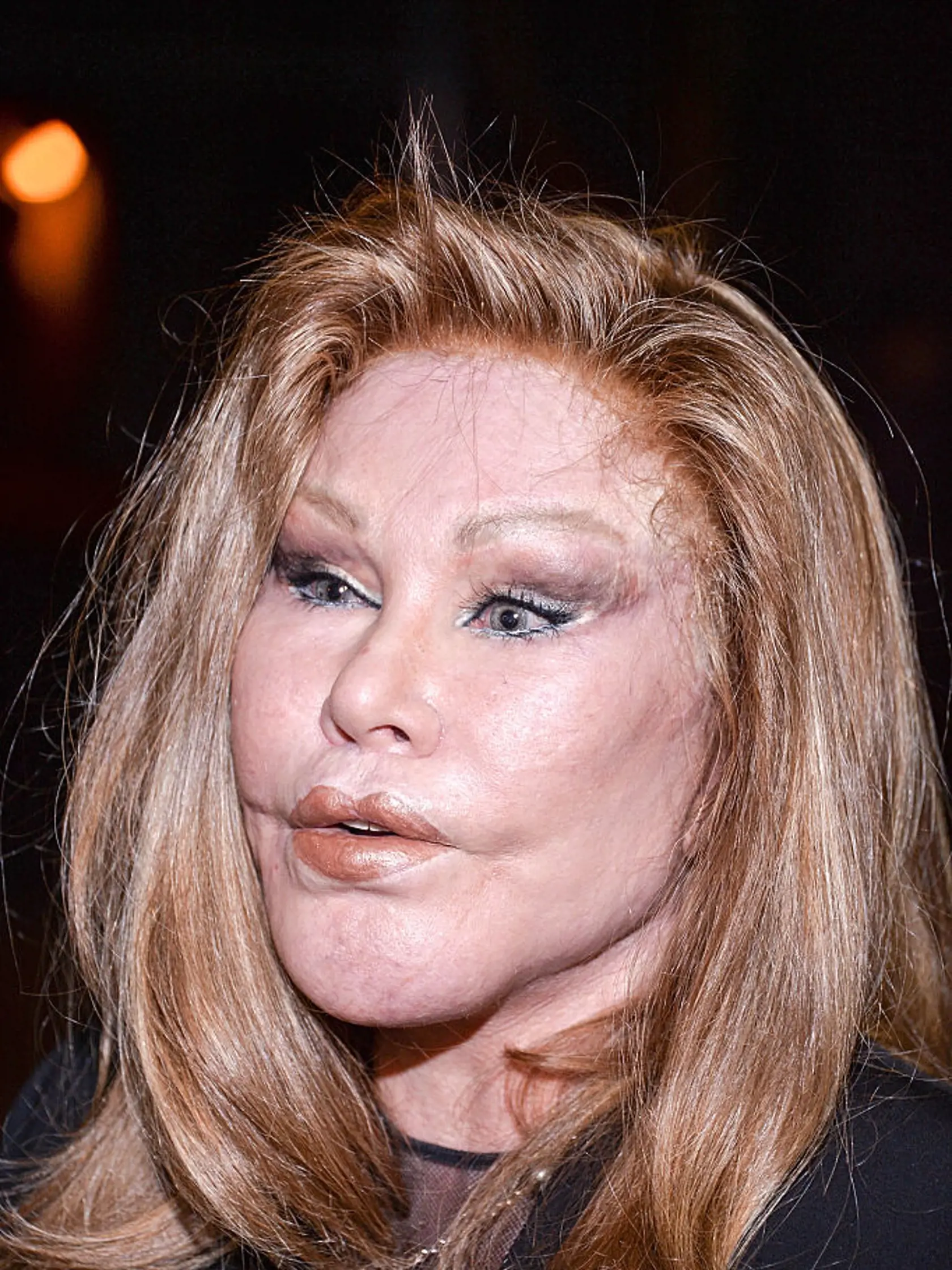Jocelyn Wildenstein