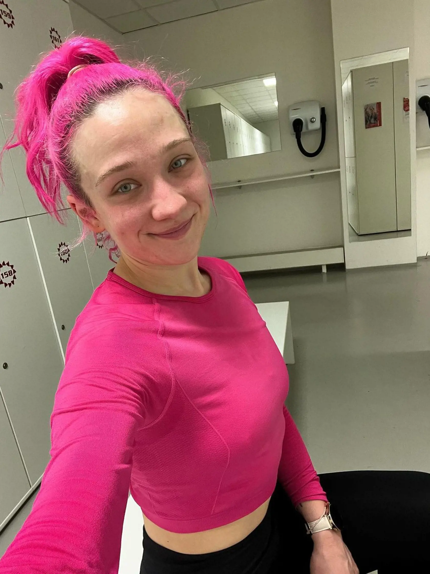 Tereza Mašková sa priznala, že ju sužuje opäť bulímia