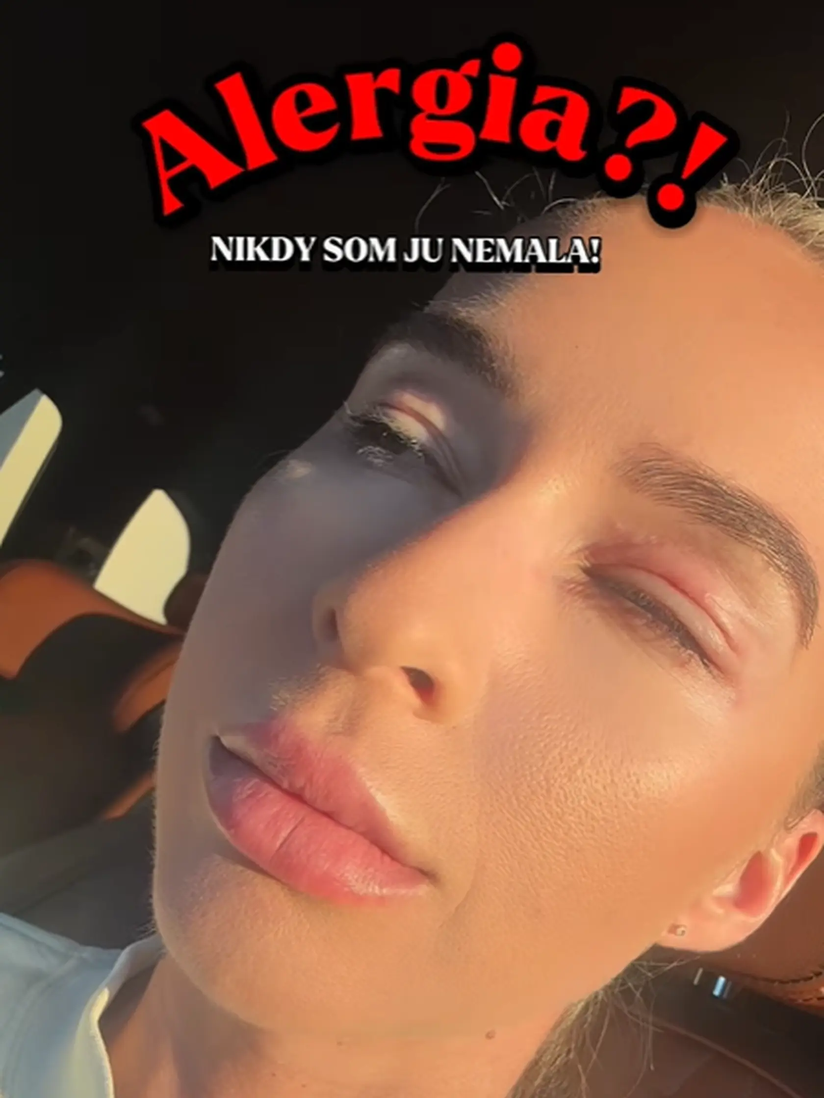 Lucia Mokráňová zverejnila záber, ktorý vystrašil fanúšikov. Takto vyzerala?