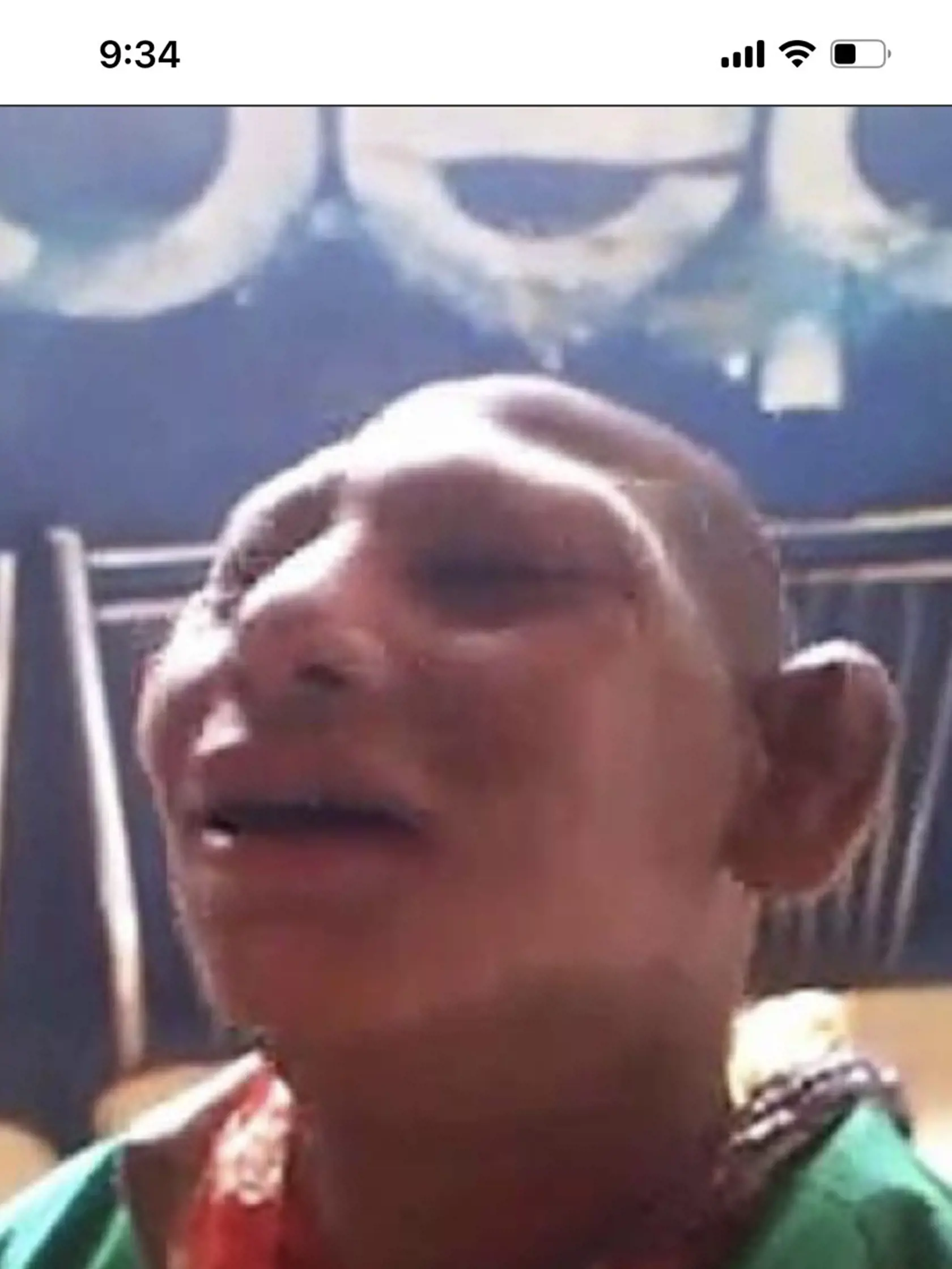 "Potkanie deti" v Pakistane žobrú na ulici.