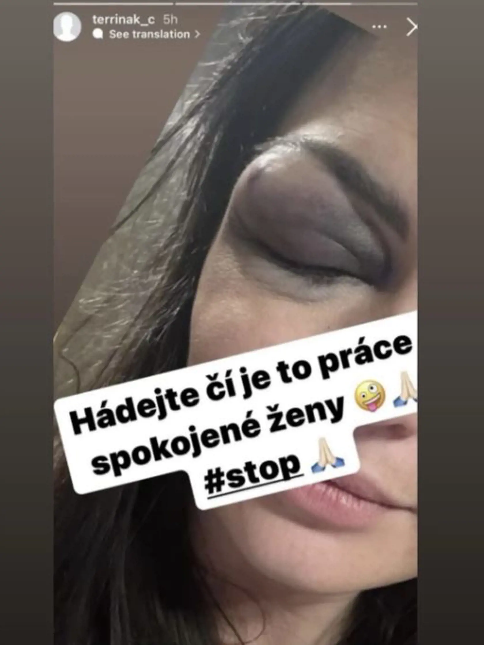 Takto dopadla Terrina, priateľka bývalého manžela Michaely.