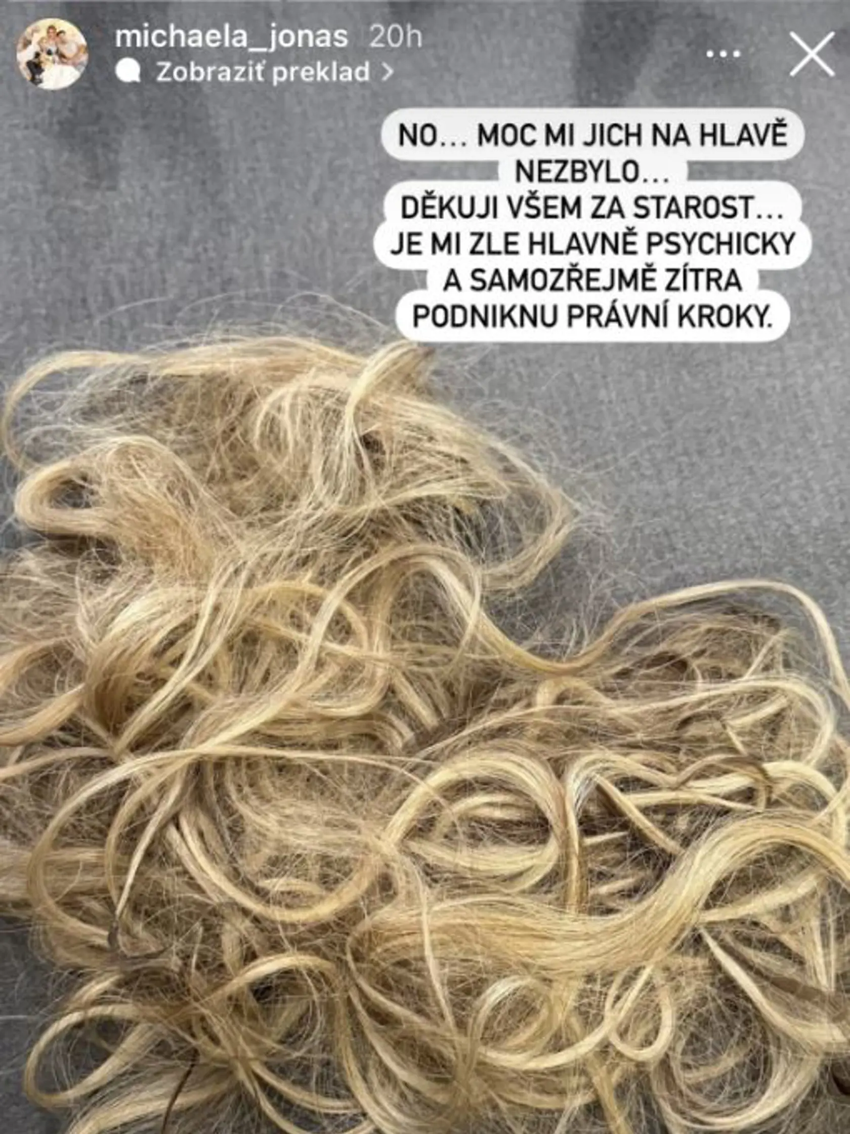 Česká influencerka Michaela Jonas skončila s vytrhanými vlasmi.