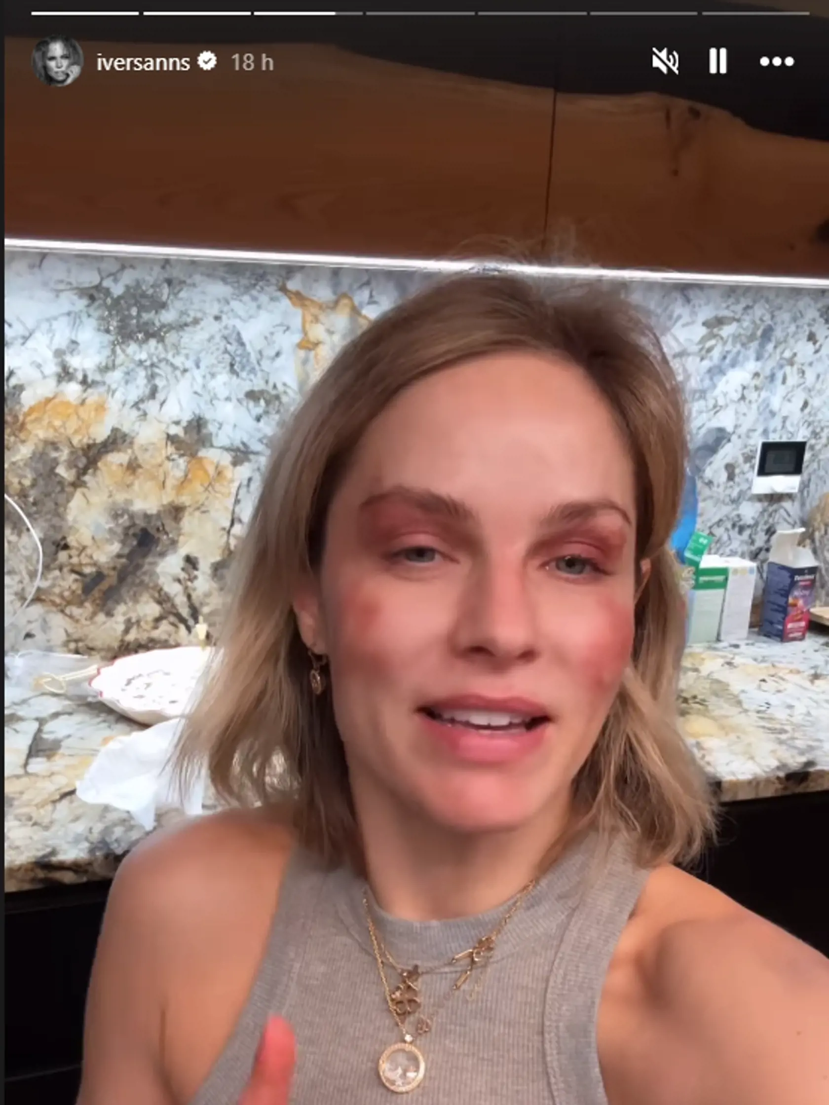 Ivana Gáborík ukázala, ako ju zmaľovala jej dcérka Bella. 