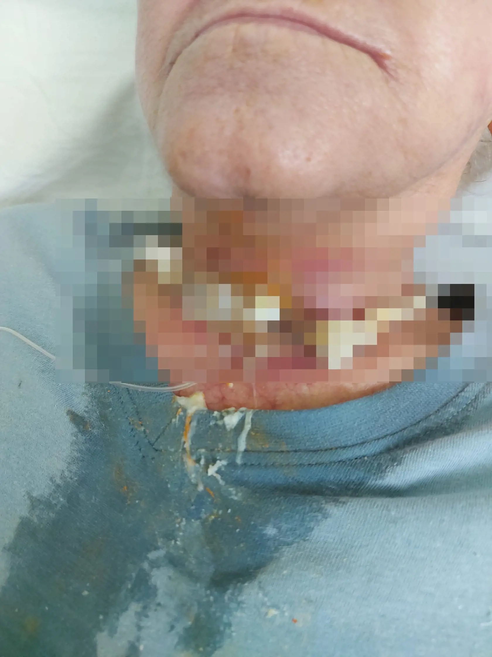 Na sociálnej sieti sa objavili fotografie z interného oddelenia bojnickej nemocnice. Práve tie mnohých poriadne šokovali. Je na nich znázornená pacientka v žalostnom stave.