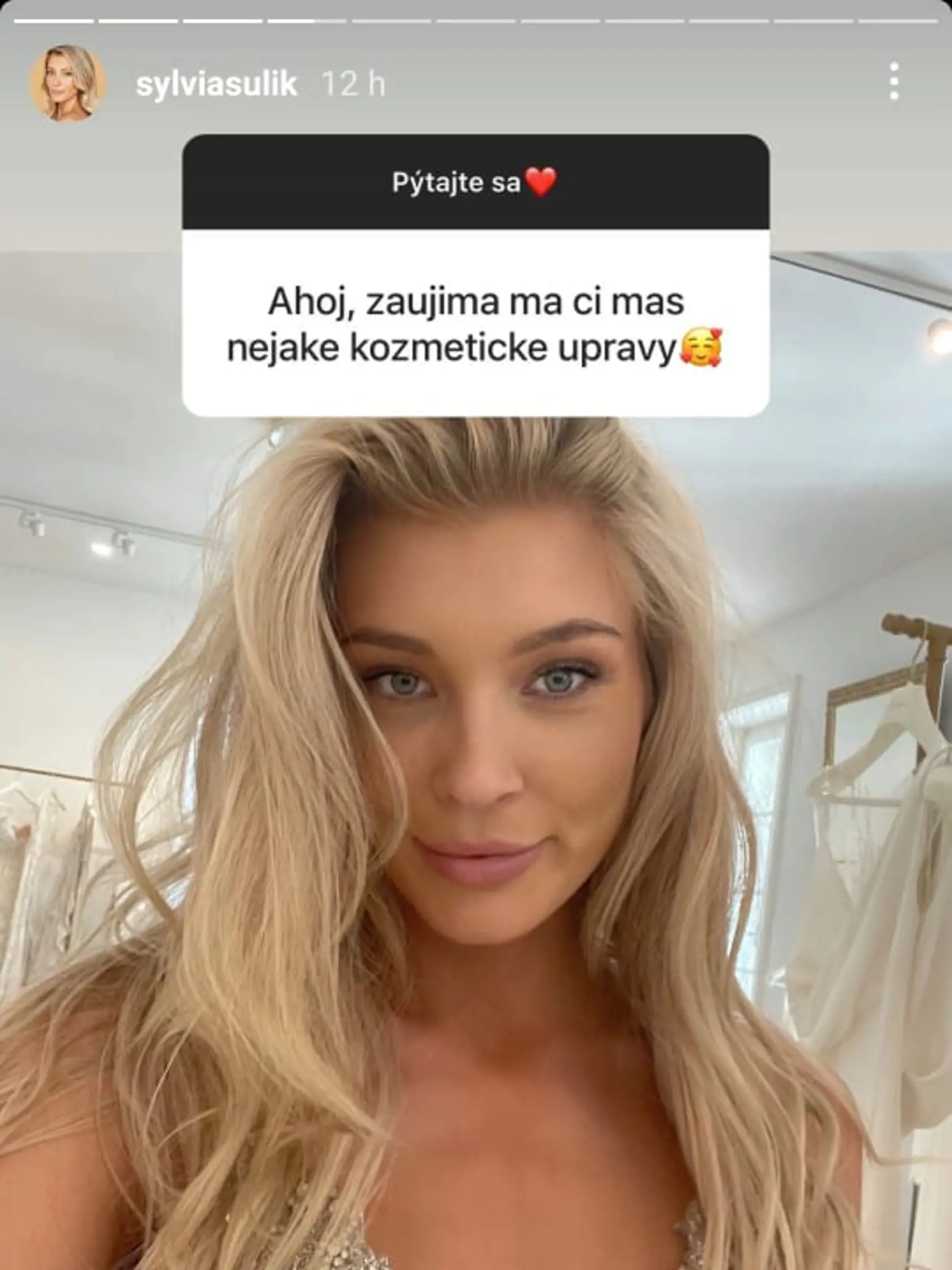Sylvia odpovedala na otázku, či má nejaké kozmetické úpravy.