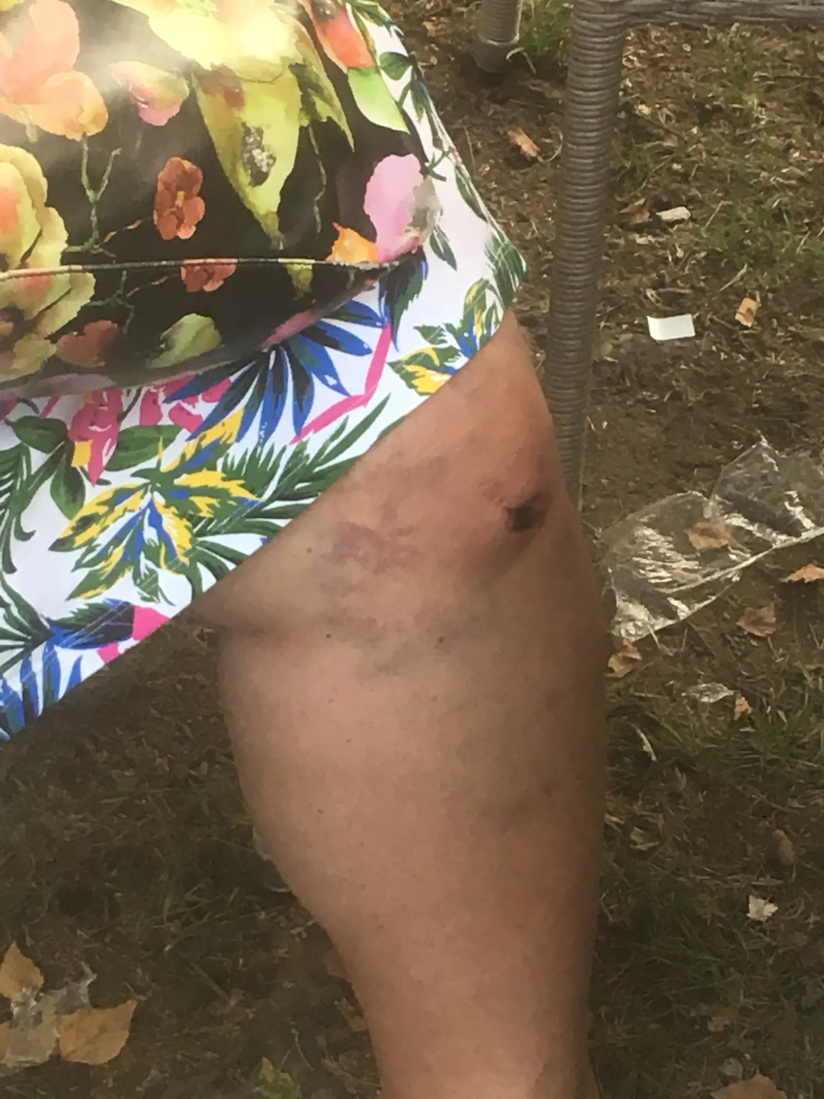 Janka Sendreiová mala po ťažkej havárii napriek zraneniam dobrú náladu a Balvalfest nezrušili.