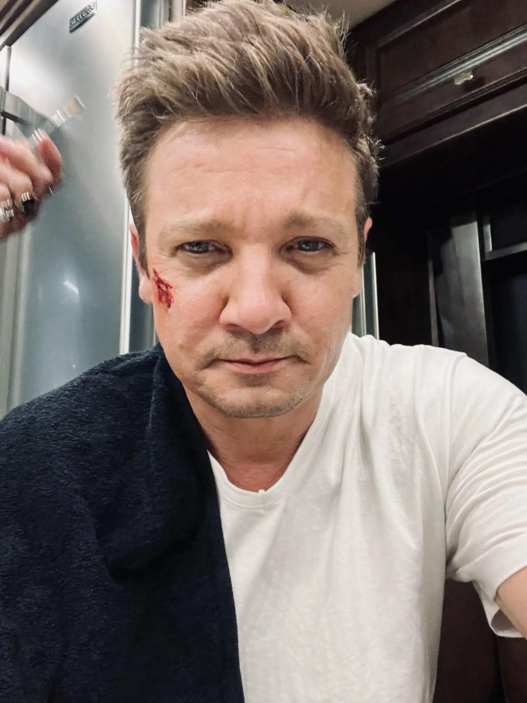Známy herec Jeremy Renner (51) bol vrtuľníkom prevezený do nemocnice keď sa počas odhŕňania snehu na jeho ranči v Siera Nevade zranil. K nehode došlo po tom, čo cez noc medzi Silvestrom a Novým rokom napadlo desiatky metrov snehu a región v Nevade zasiahla masívna zimná búrka.