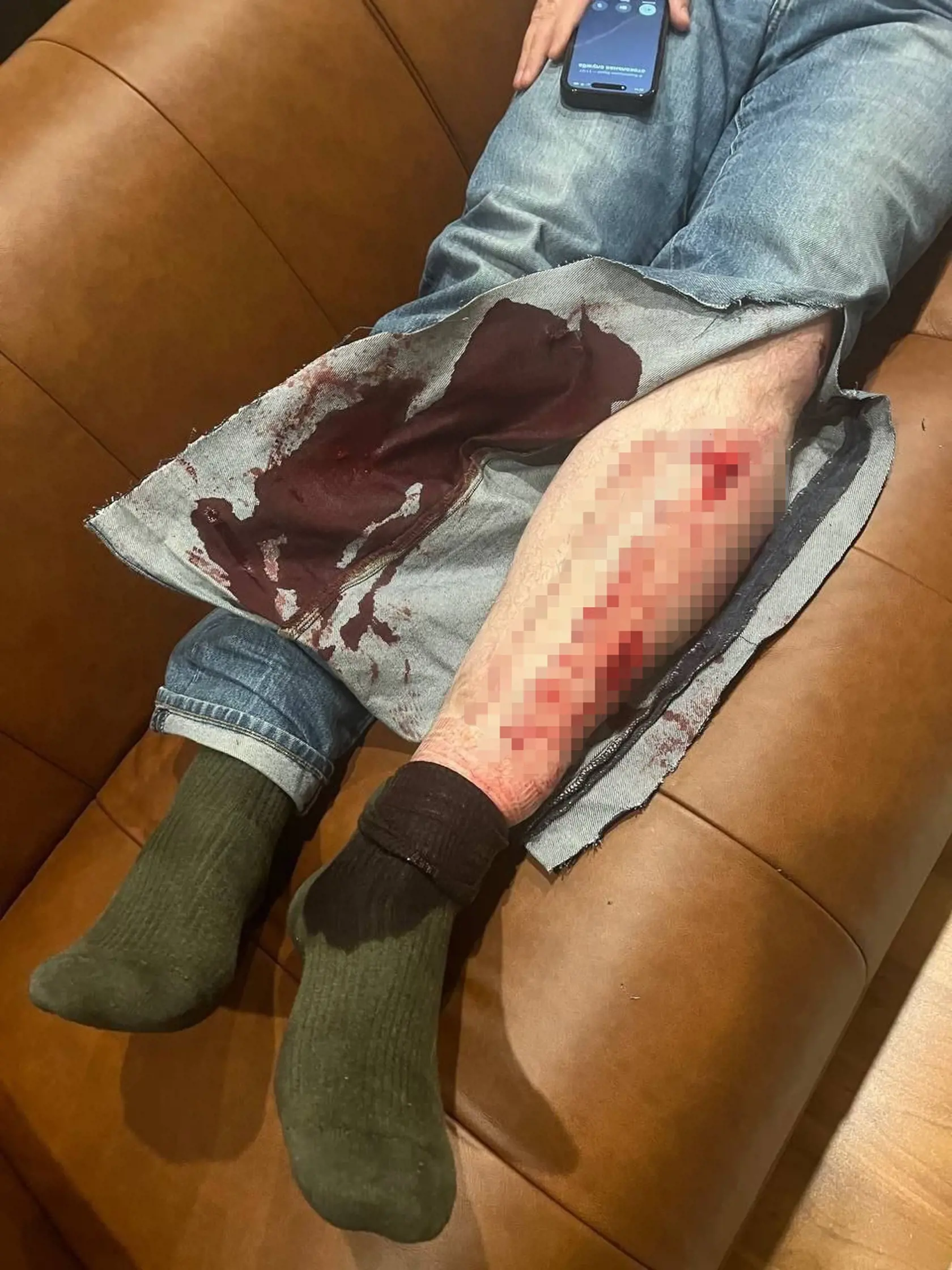 Najprv zaútočili slzotvorným plynom a následne začali mlátiť kladivom.