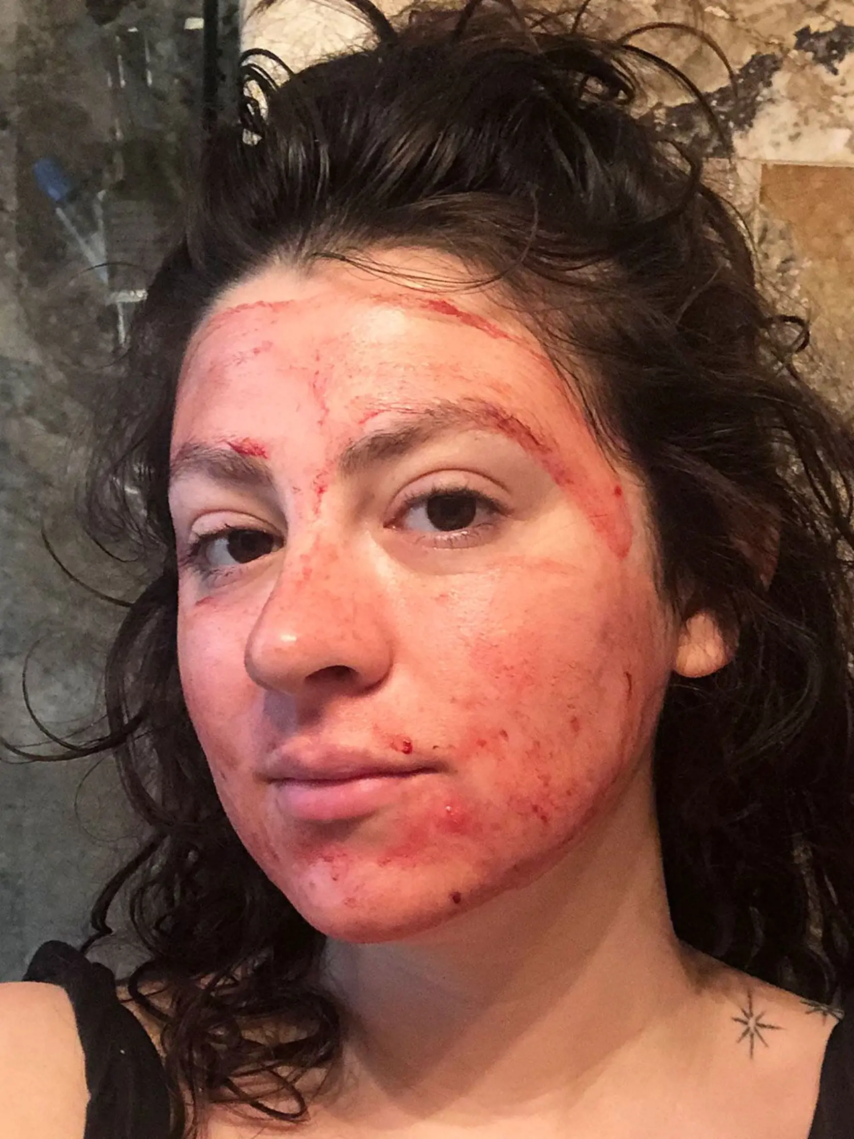 Ženy využívajú menštruačnú krv ako pleťovú masku. Odborníci to však neodporúčajú