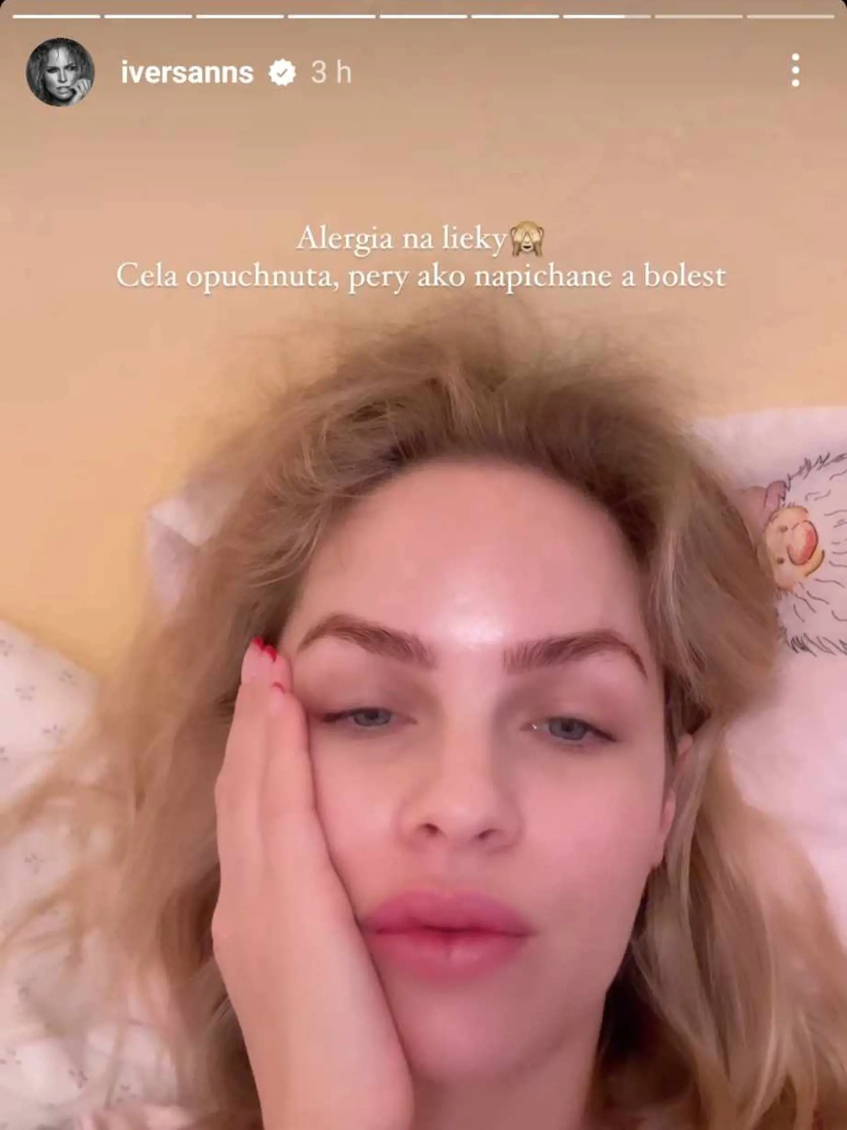 Ráno sa zobudila celá ubolená.