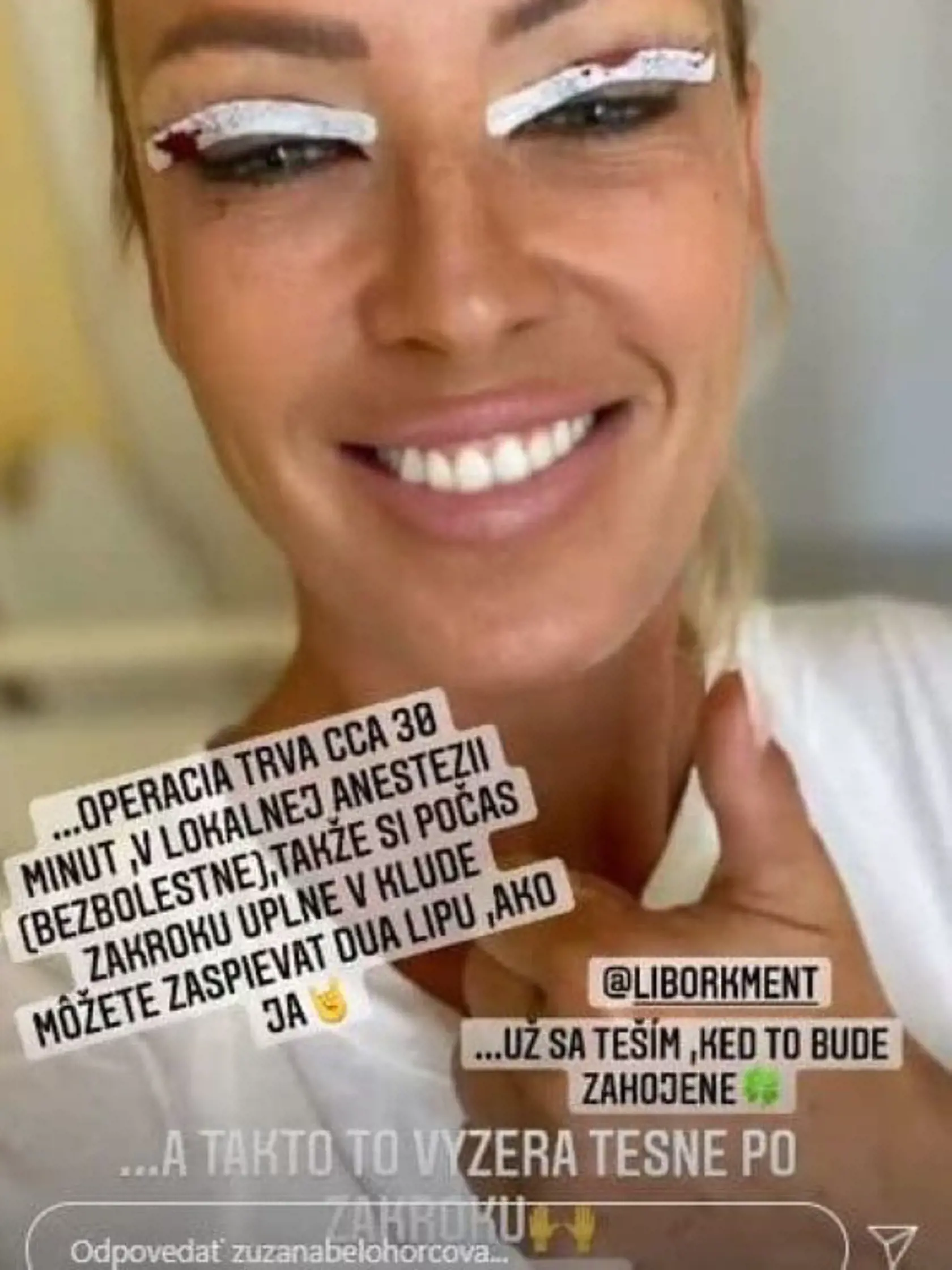 Zuzana Belohorová po operácii horných viečok.