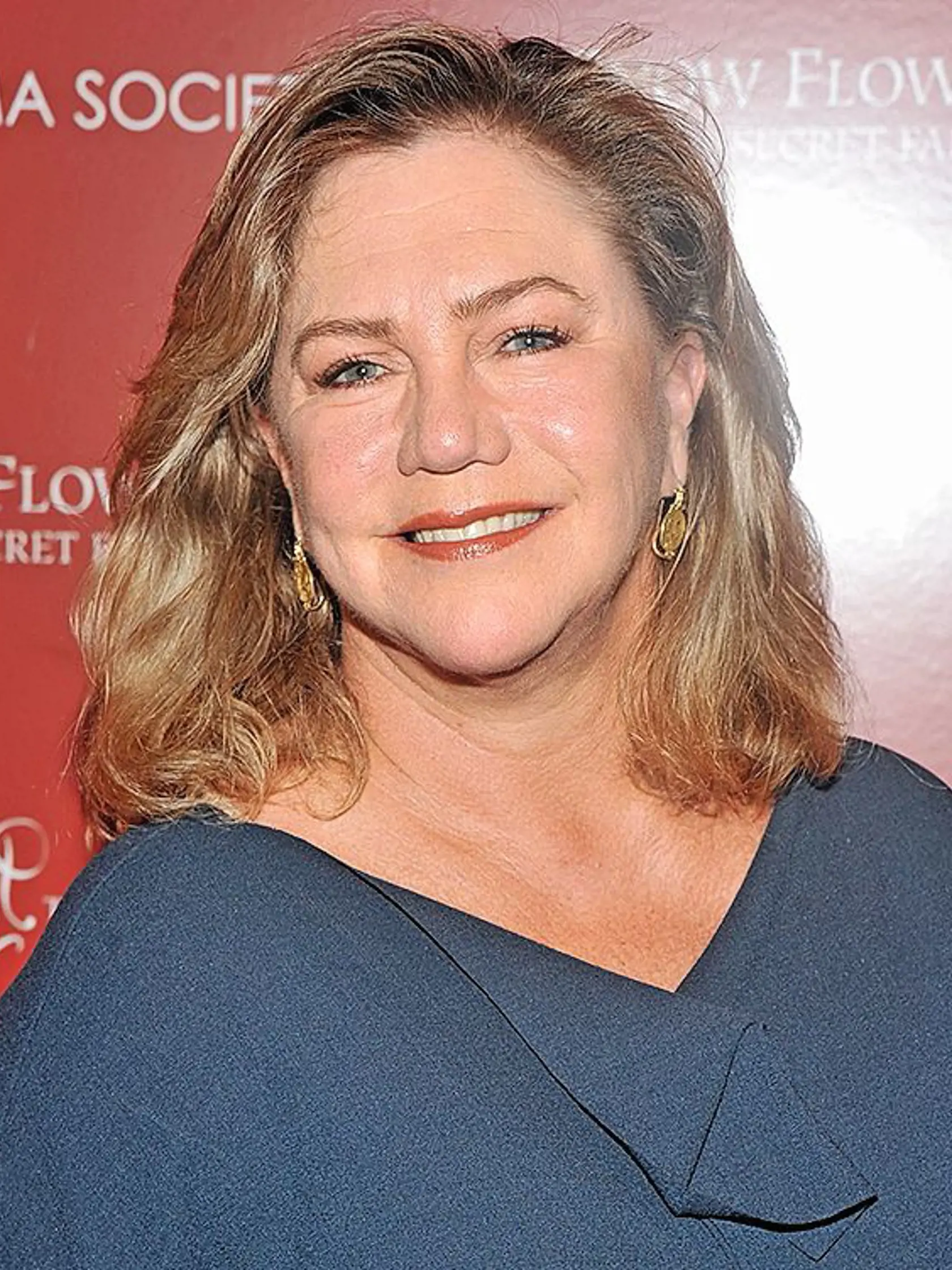 So zápalom, reumatoidnou artritídou, si užila svoje aj herečka Kathleen Turner. „Vzhľad a byť sexy je zrazu druhoradé, ako spraviť krok bez bolesti,&quot; vyjadrila sa, keď jej lekári po rokoch príznakov potvrdili chorobu, ktorá jej napadla mäkké tkanivá a kĺby.