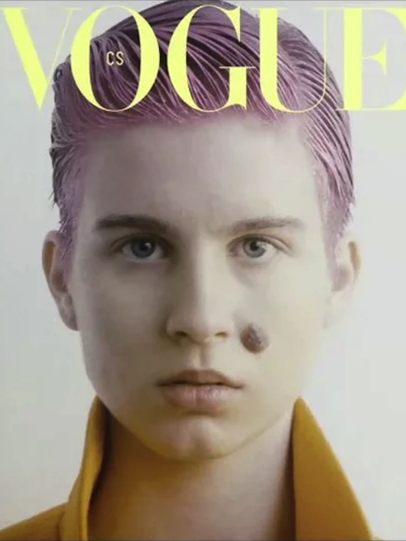 Emme Čaputovej našli pri bežnej kontrole v mozgu nádor.