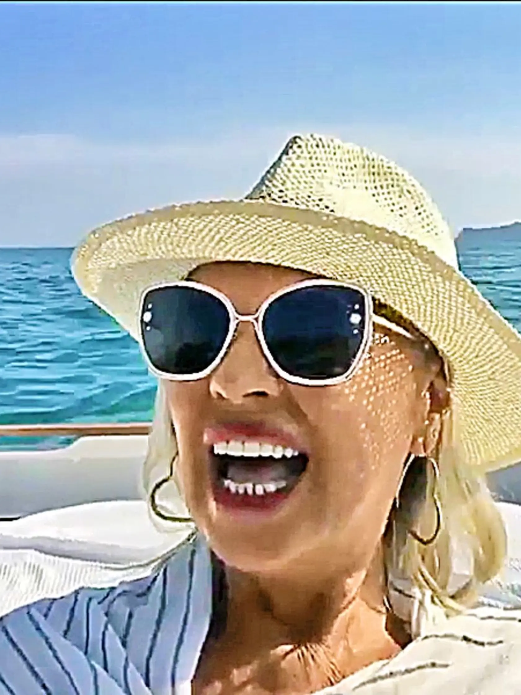 Eva sa pochválila novým hollywoodskym chrupom.