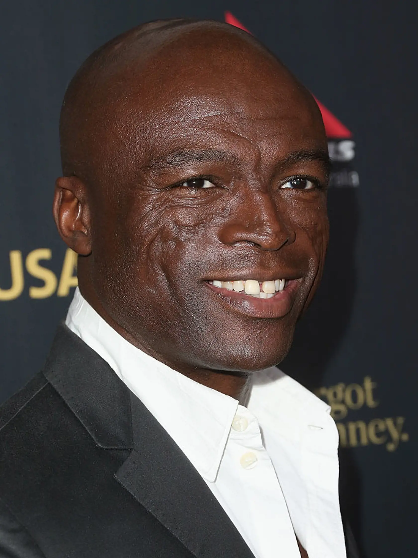 Seal má nigérijsko-brazílsky pôvod. Na tvári má charakteristické jazvy. Tie spôsobila autoimunitná choroba lupus erythematosus, ktorá ho postihla v detstve. 