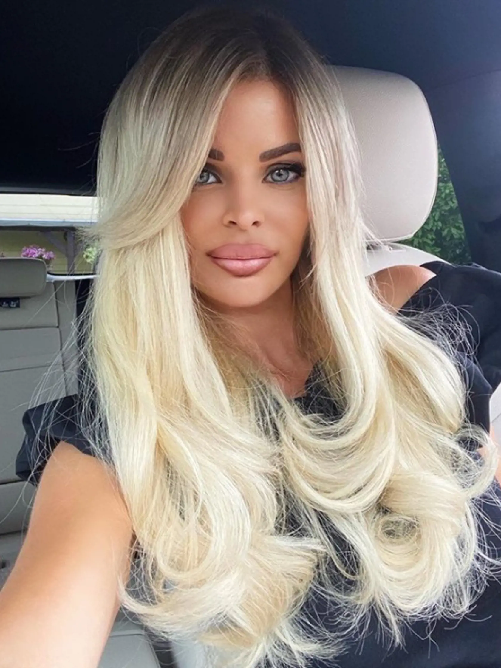 Silvia Kucherenko: Najskôr zmenila farbu vlasov z platinovej na špinavú blond. Potom si dala zmenšiť kačacie pery. Takto vyzerá návrat k akej-takej prirodzenosti plastikovej modelky barbie.