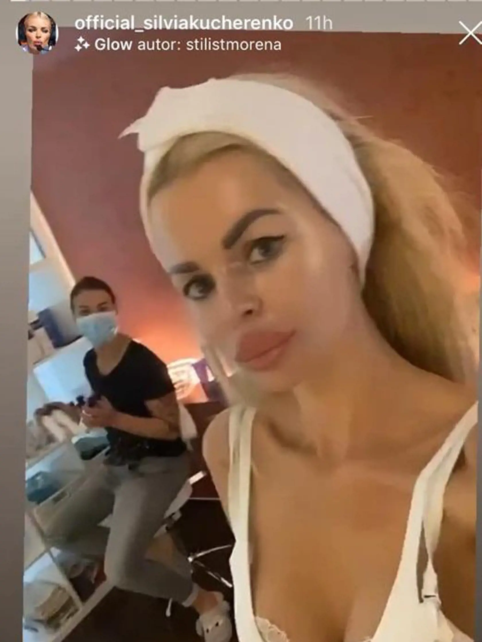 Silvia Kucherenko má opäť väčšie pery.