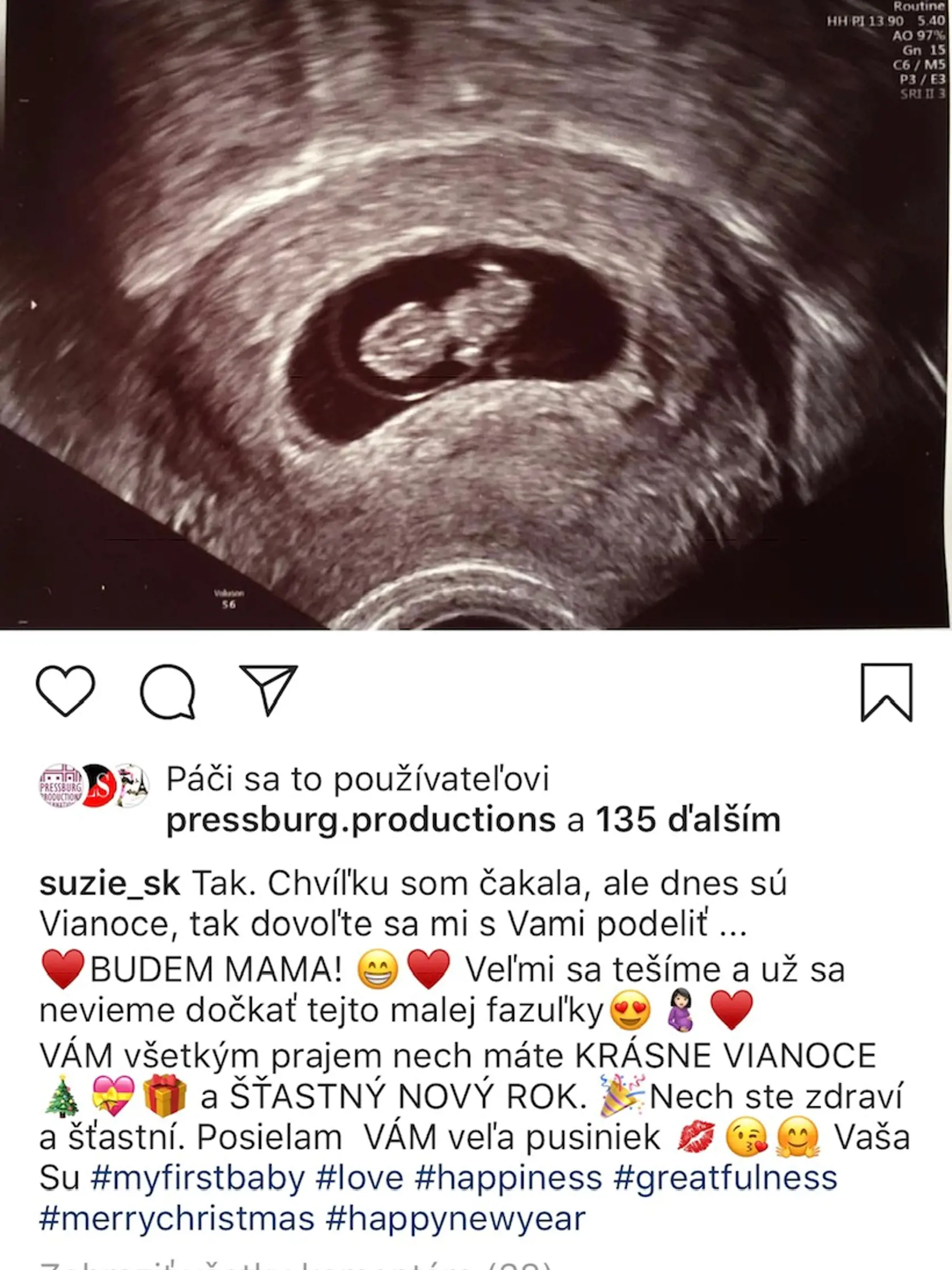 Suzie zverejnila aj foto z ultrazvuku.