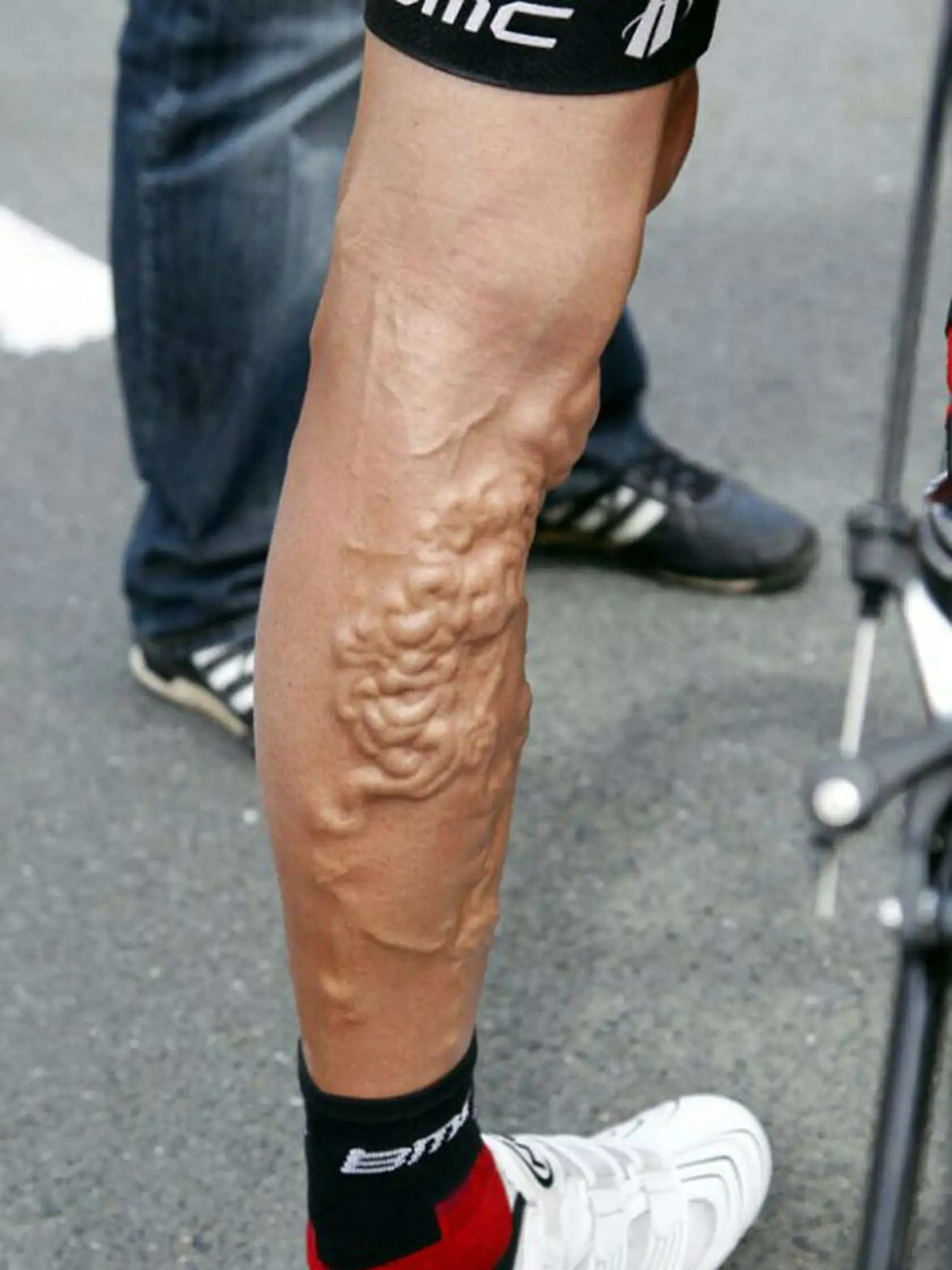George Hincapie a jeho nohy po Tour de France.