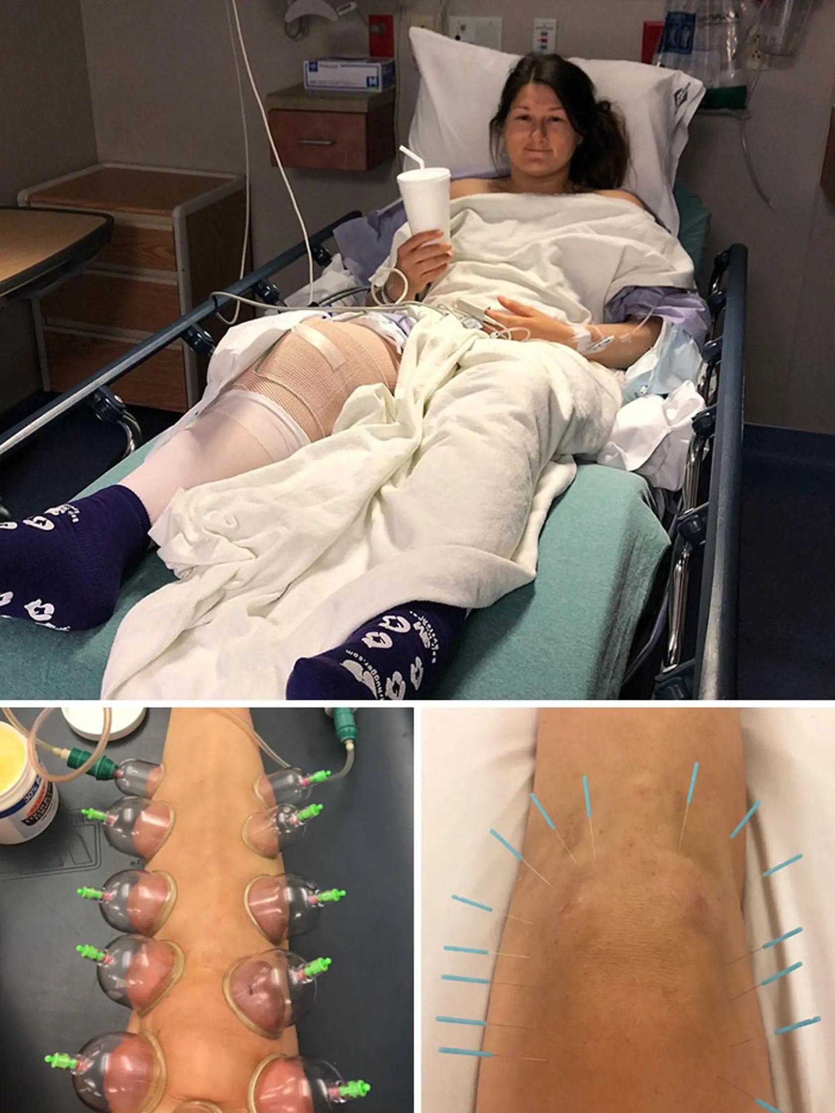 Terapia pohármi je využívaná najmä v Ázii a východnej Európe a vo všeobecnosti je považovaná za alternatívnu medicínu.