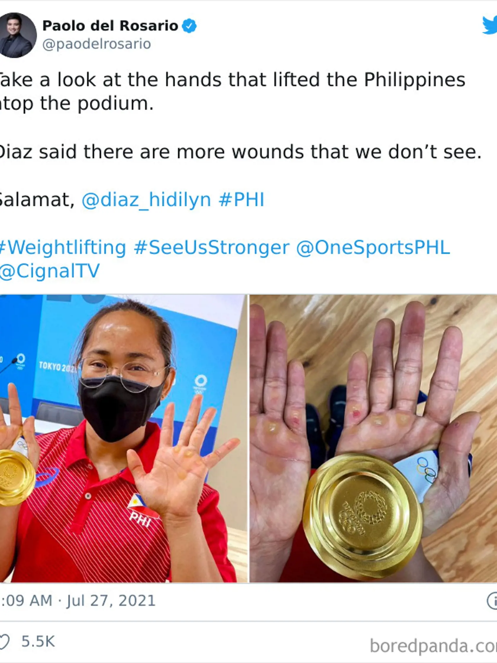 Takto vyzerajú ruky prvej filipínskej zlatej olympioničky Hidilyn Diaz, ktorá sa venuje vzpieraniu.