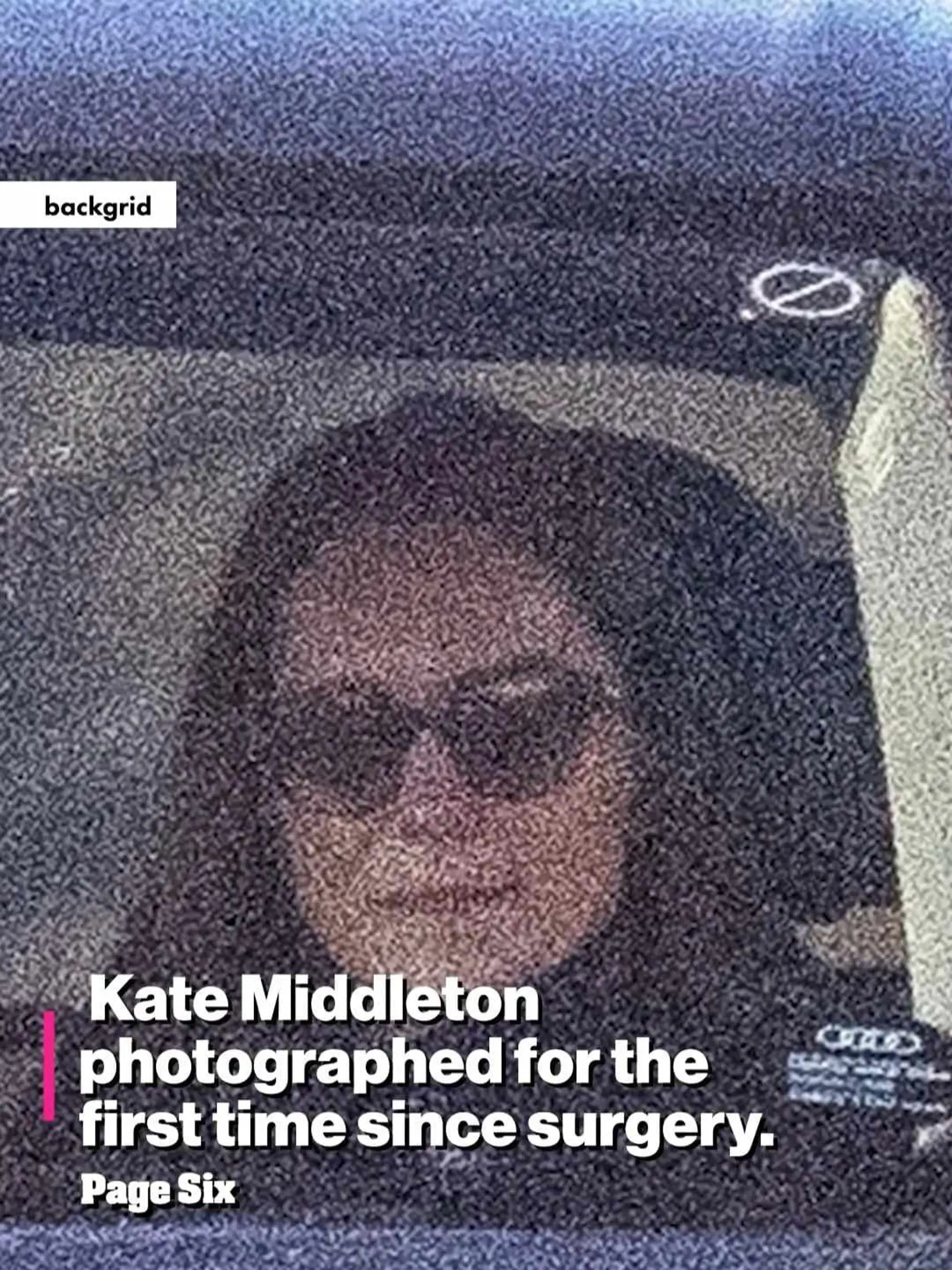 Kate sa ukázala prvýkrát na verejnosti. Takto vyzerá 2 mesiace po operácii.