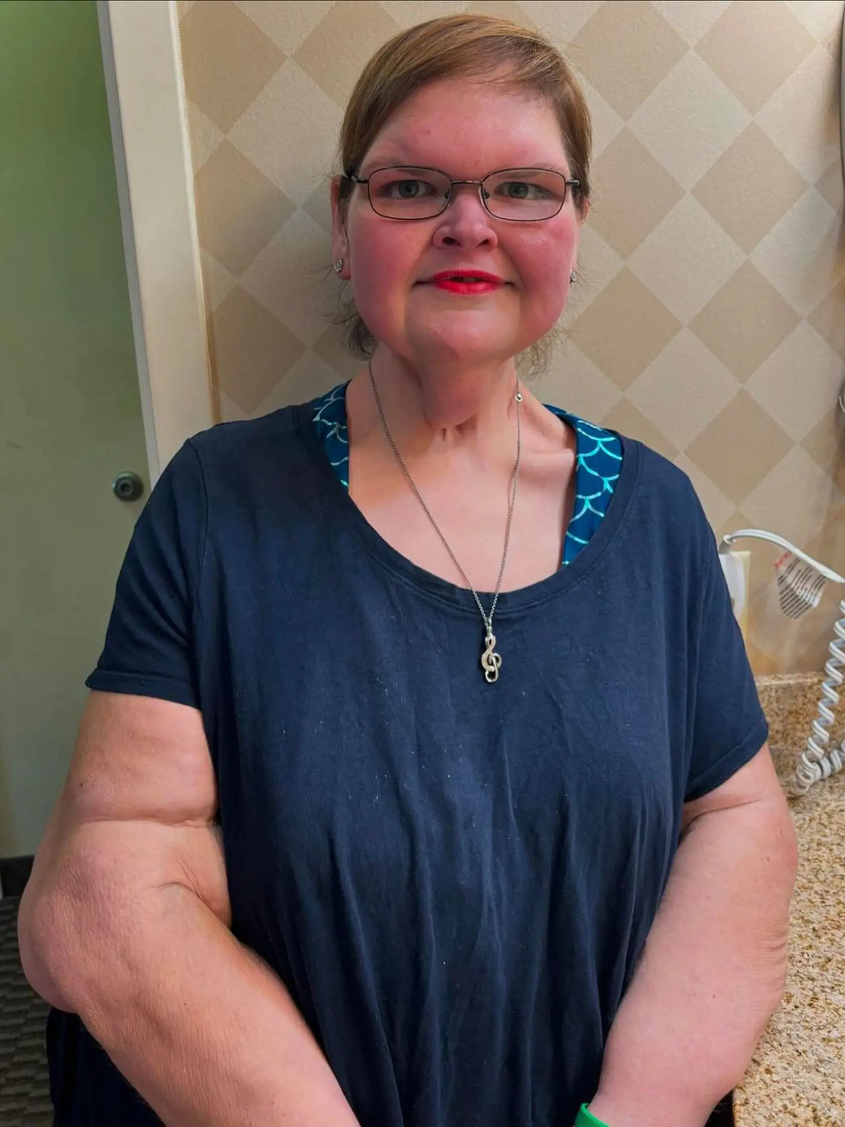 Tammy už schudla viac ako polovicu svojej pôvodnej váhy.