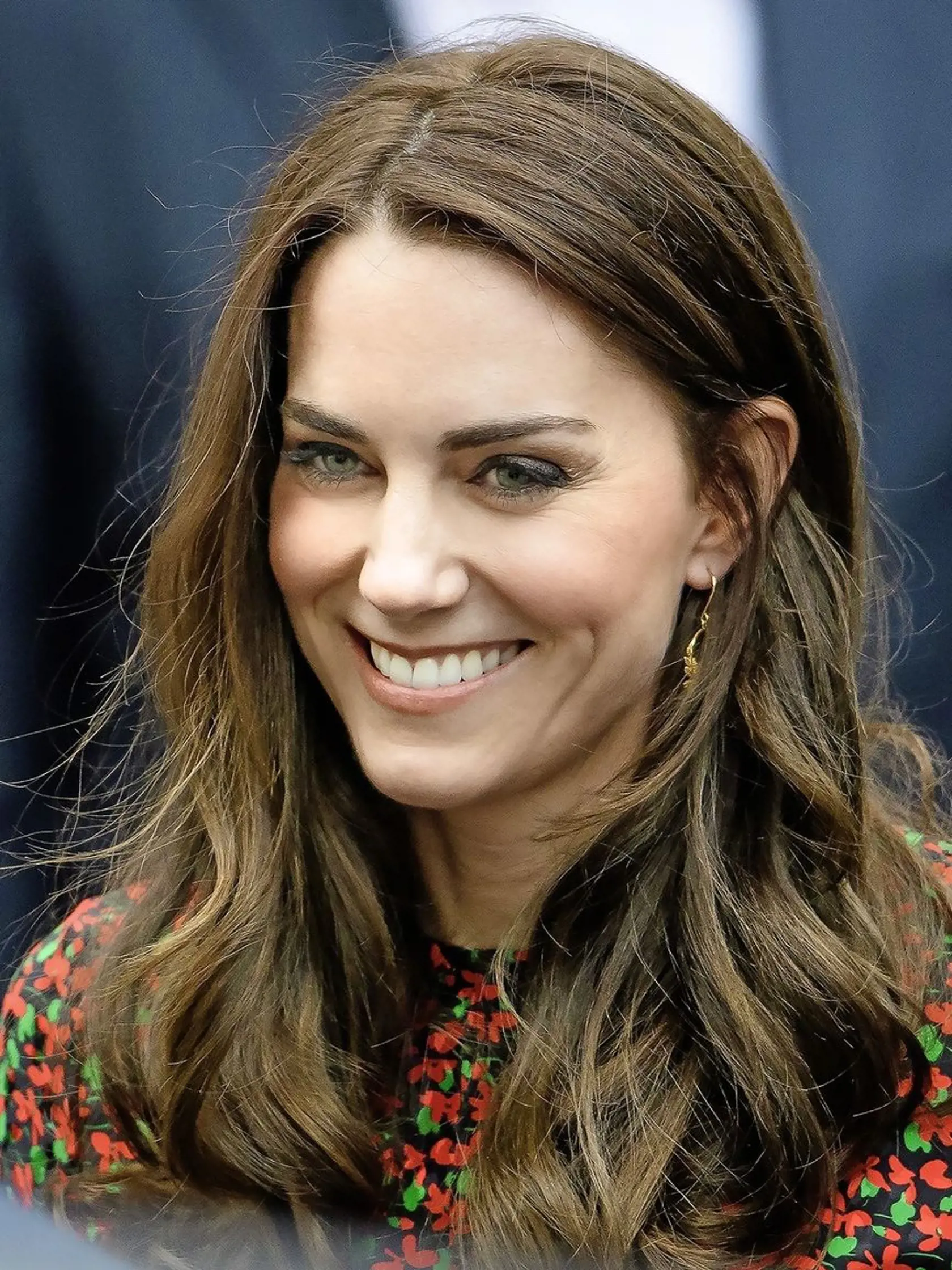 Kate Middleton (37) bojuje s nedokonalou pokožkou a najväčšie problémy mala ako tínedžerka, keď sa jej na tele objavovali červené mokvajúce fľaky.