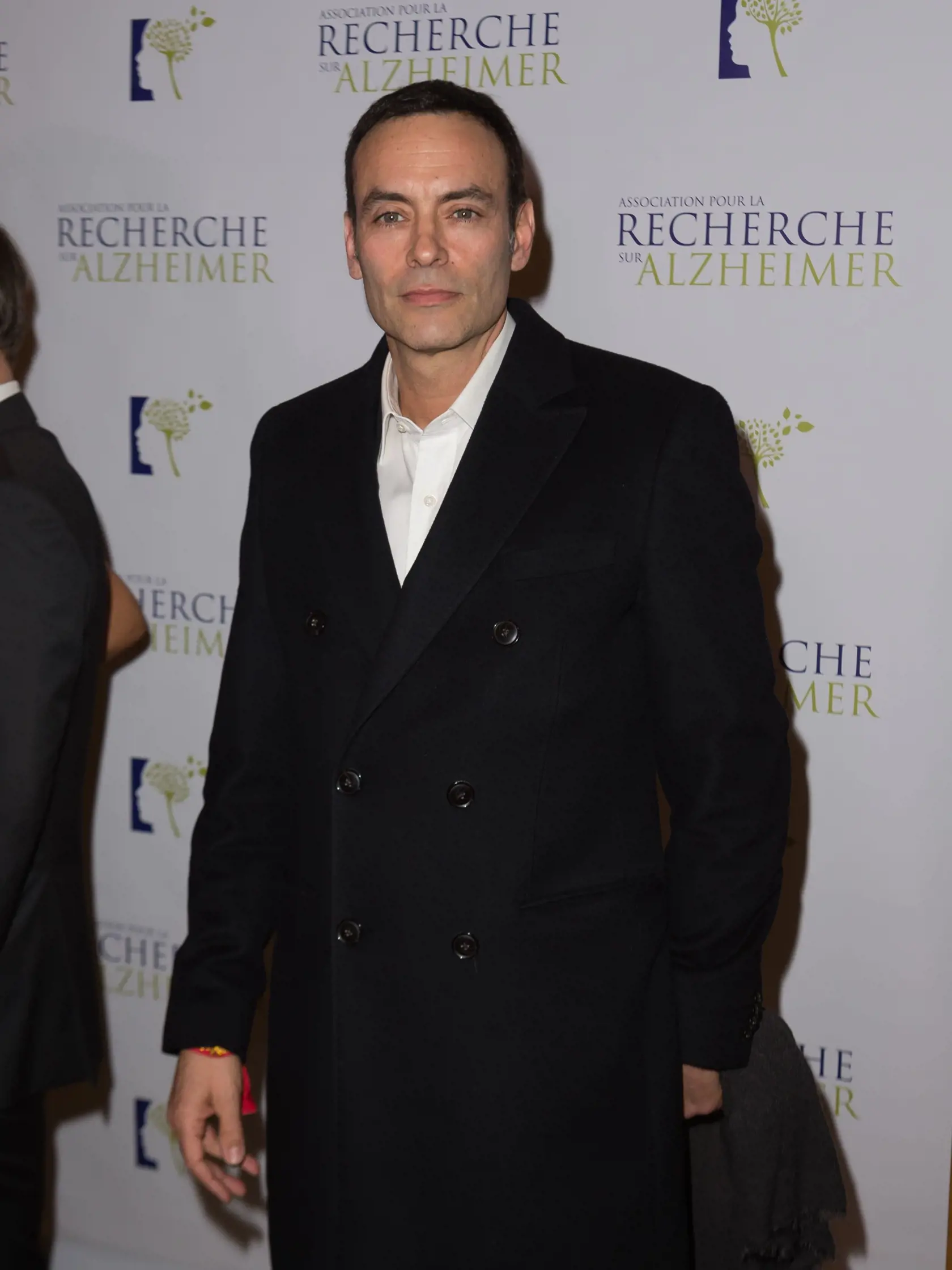 Anthony Delon