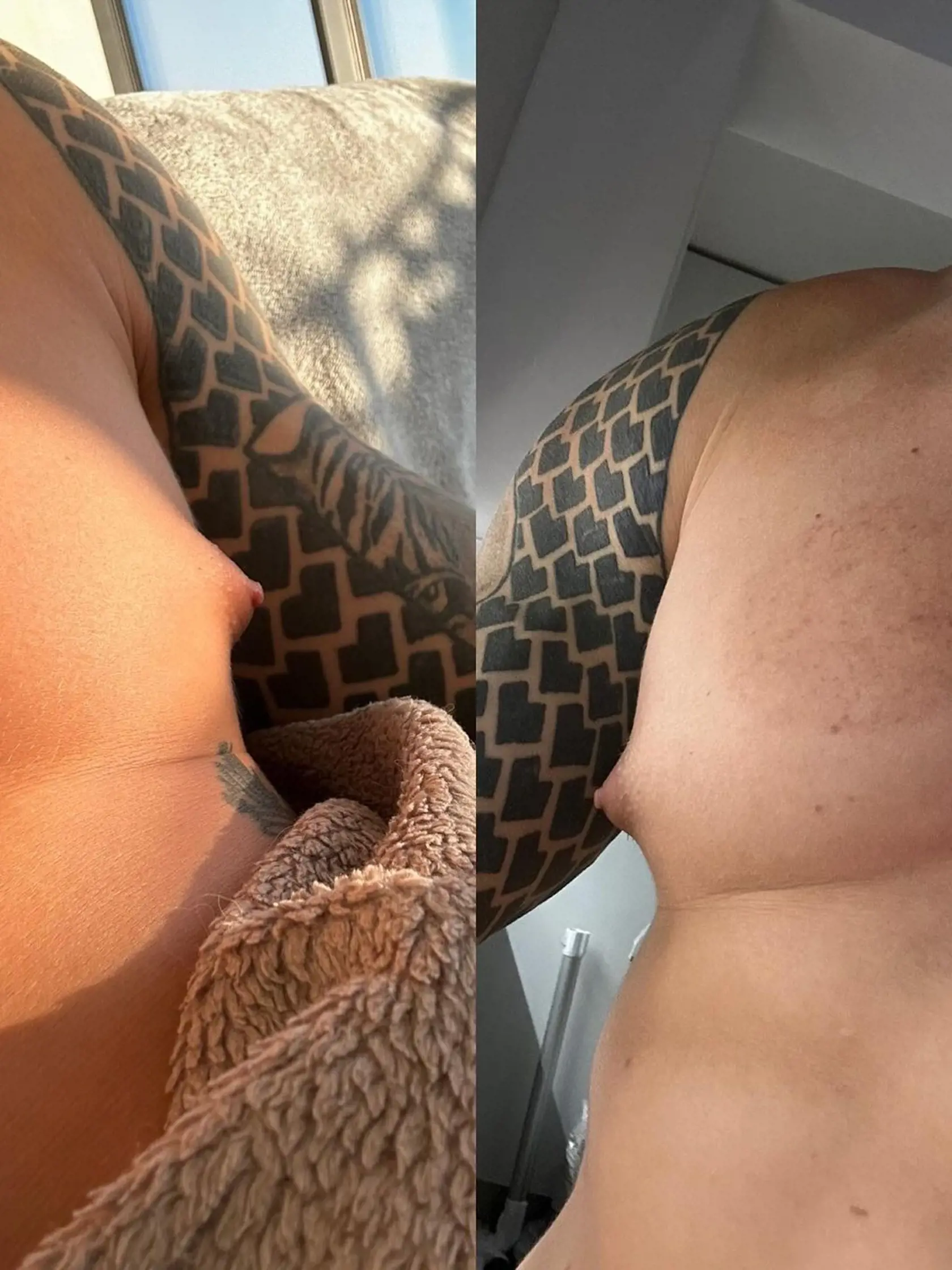 Kryštof Novák z Love Island podstúpil plastiku pŕs. Takto vyzerali jeho prsia pred zákrokom.