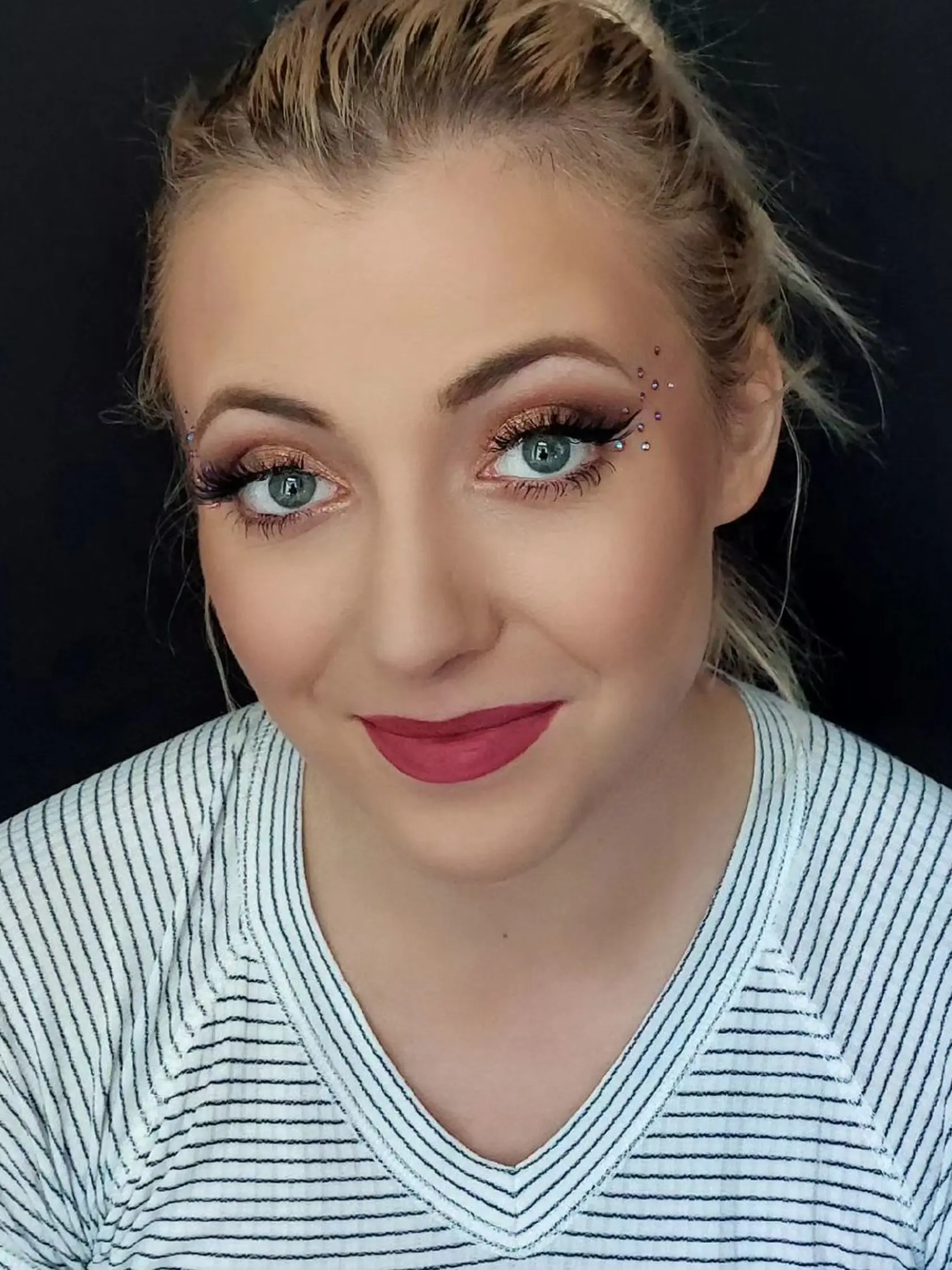 Anička Slováčková (†29) kvôli chorobe prišla o svoje vlasy.