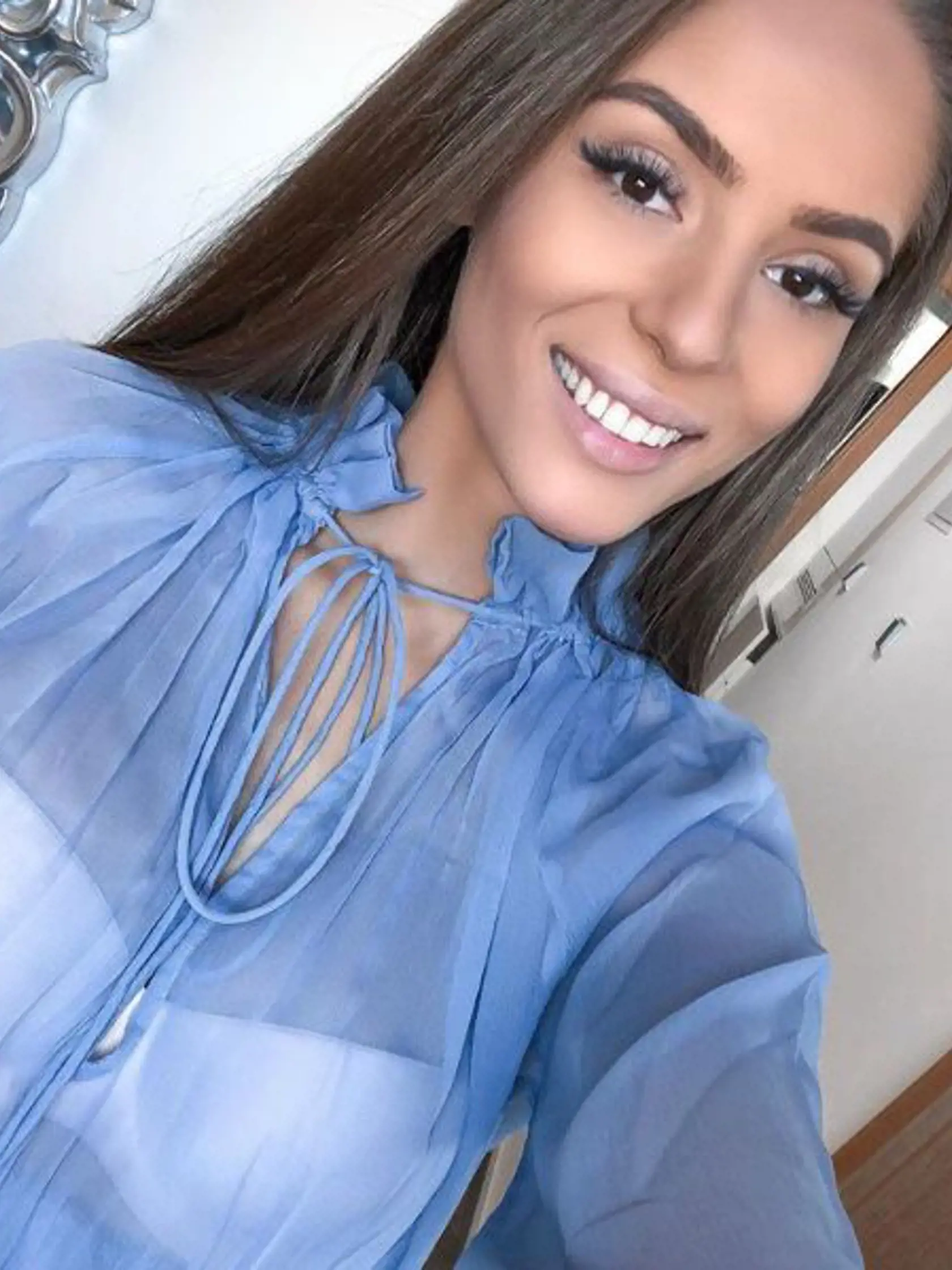 Česká youtuberka Kristýna Třešňáková alias Týnuš utrpela popáleniny na 35% tela.