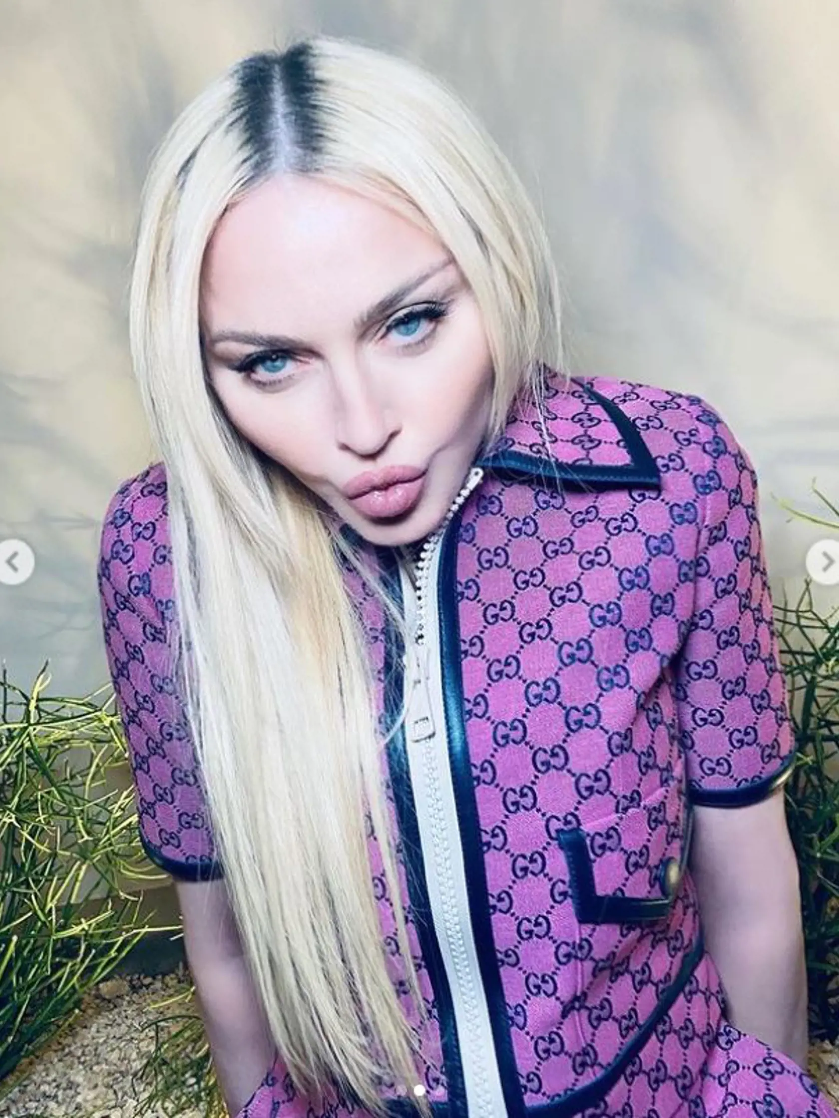2021 - Nové zábery fanúšikov iba utvrdili v tom, čo si mysleli už dlhšie. Madonna podľa nich podstúpila plastickú operáciu.
