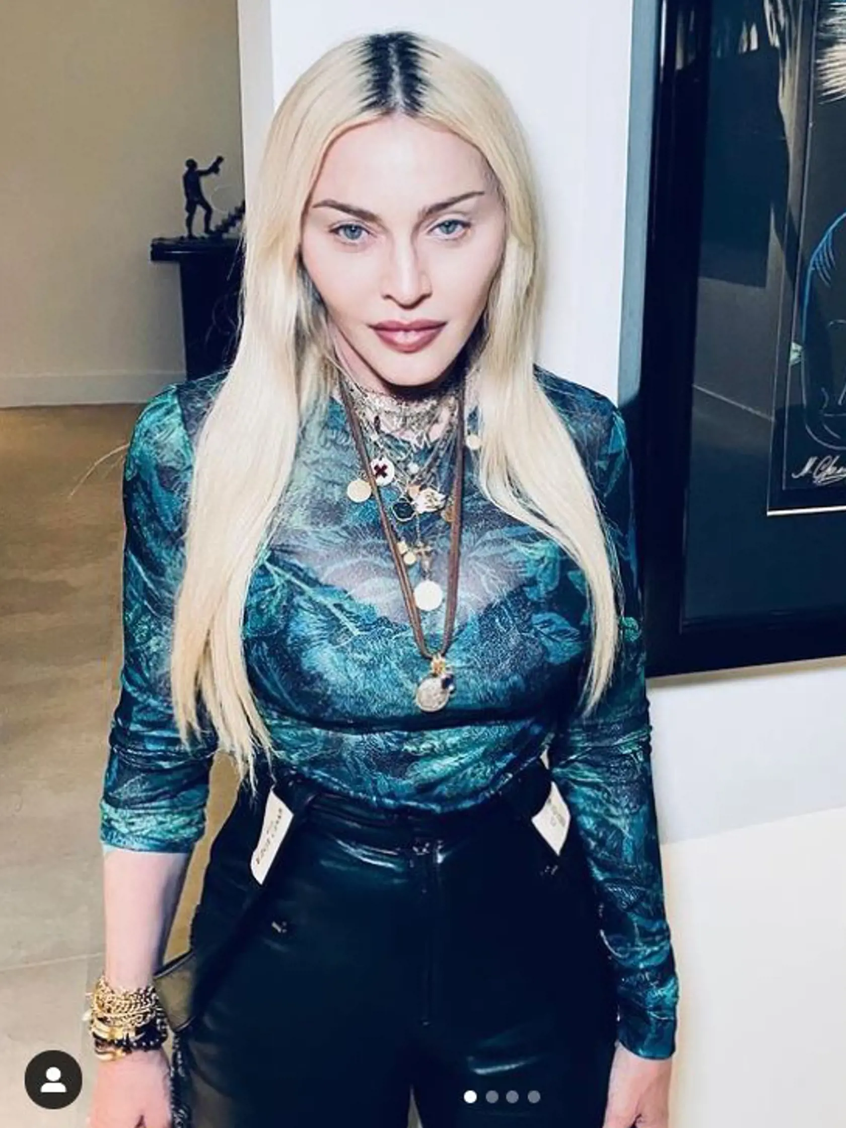 2021 - Nové zábery fanúšikov iba utvrdili v tom, čo si mysleli už dlhšie. Madonna podľa nich podstúpila plastickú operáciu.