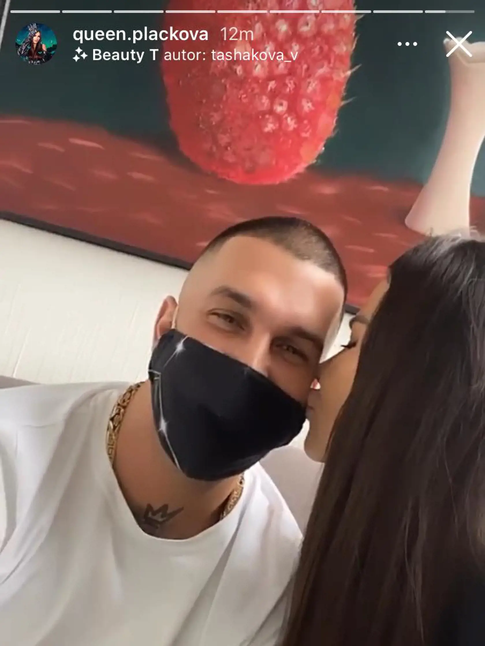 Plačková sa ukázala po kompletnej plastike tváre.