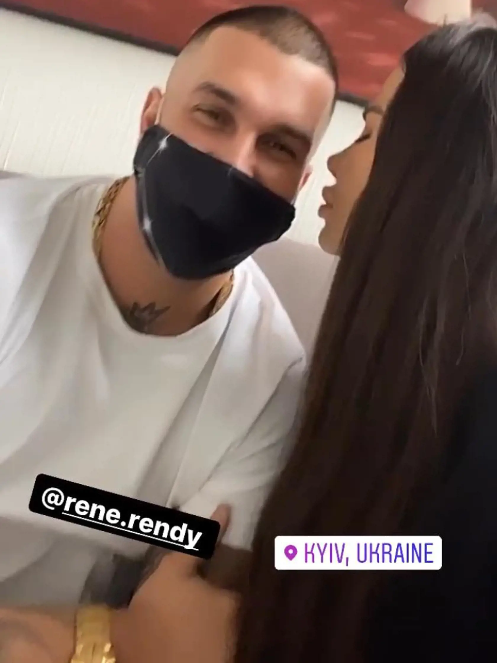 Plačková sa ukázala po kompletnej plastike tváre.