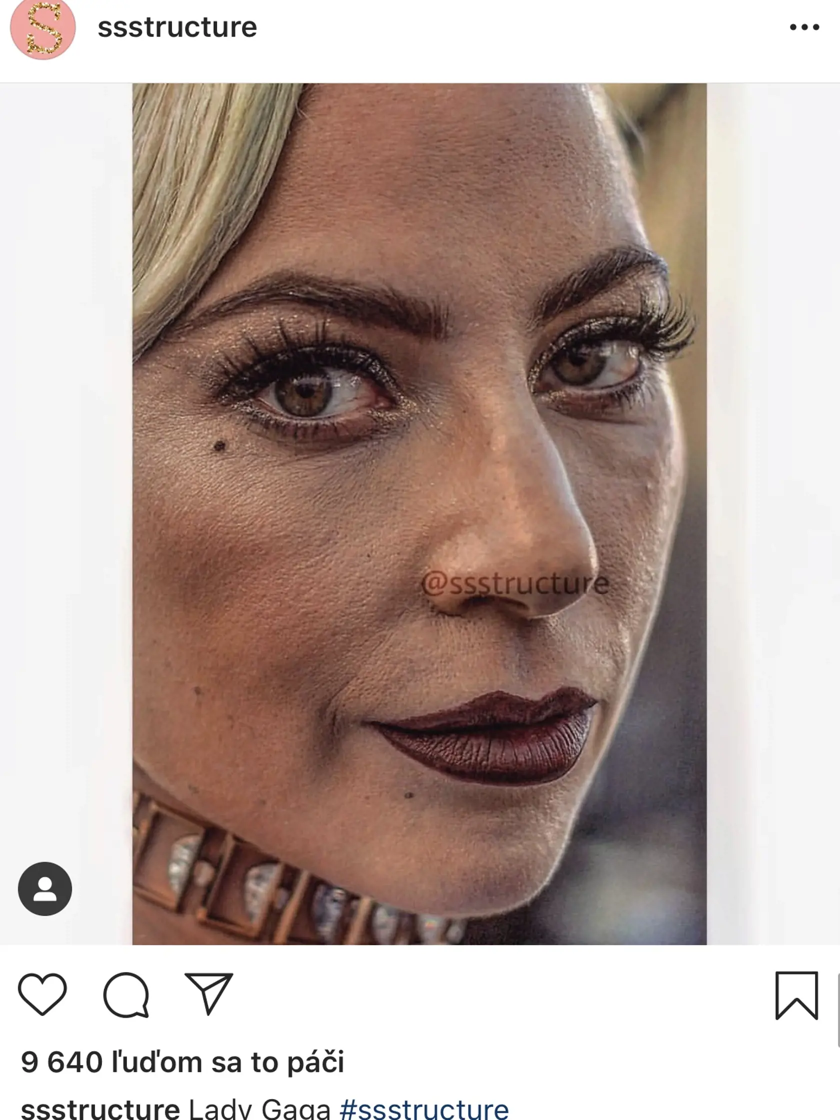 Speváčka Lady Gaga tiež nemá dokonalú pleť.