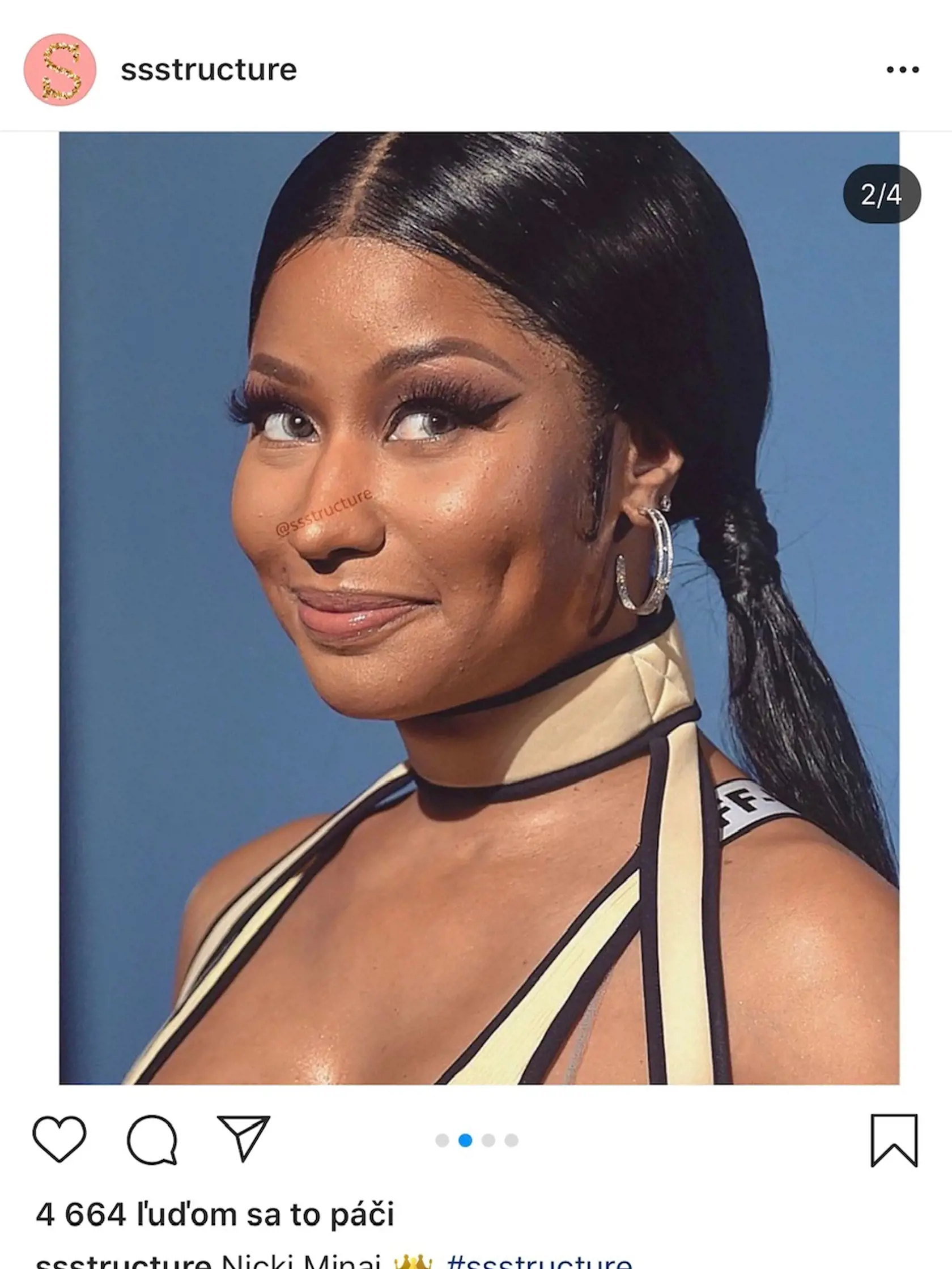 Nicki a jej pleť pod drobnohľadom.