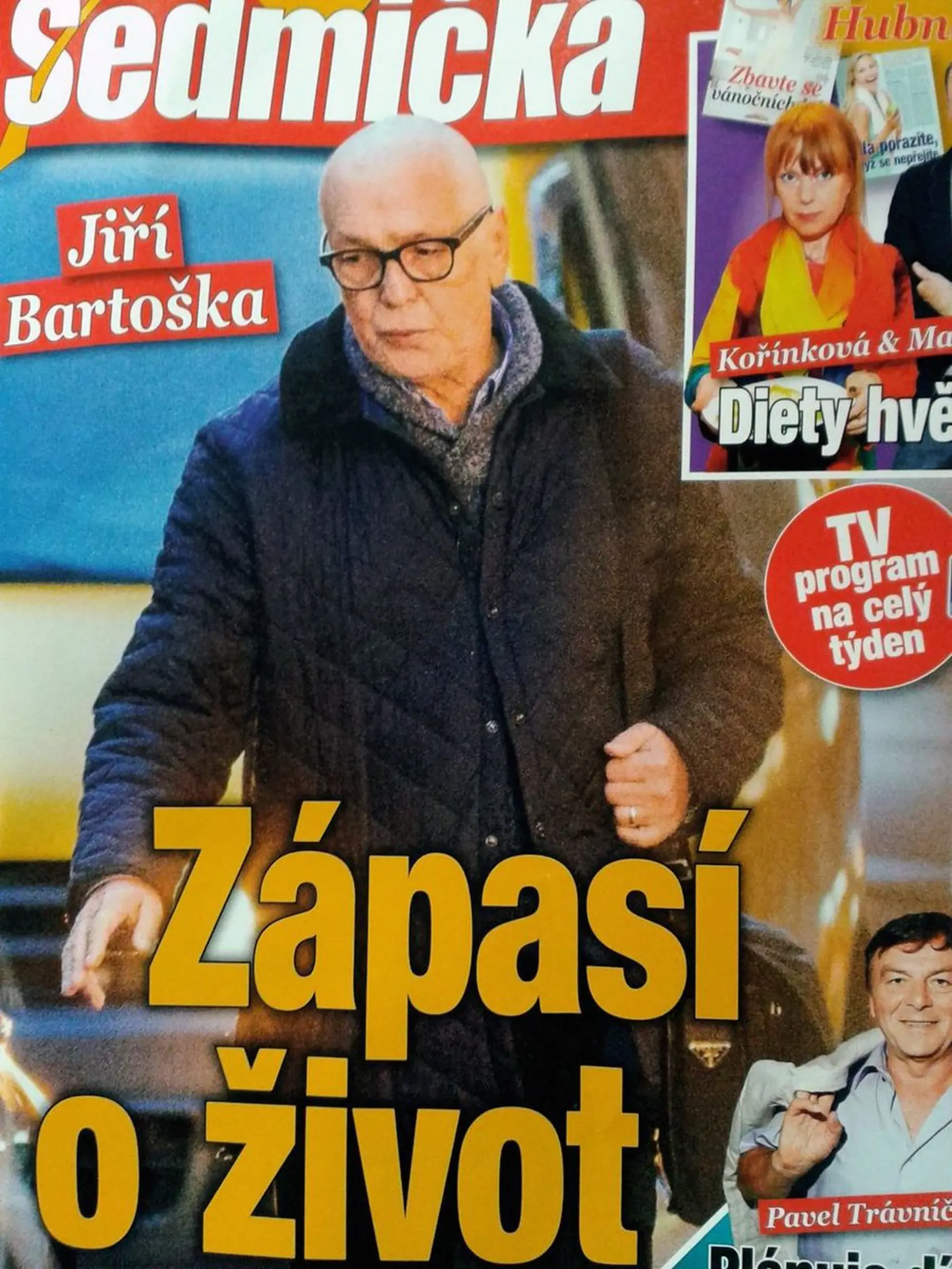 Herec prišiel pre chorobu o svoje husté vlasy.