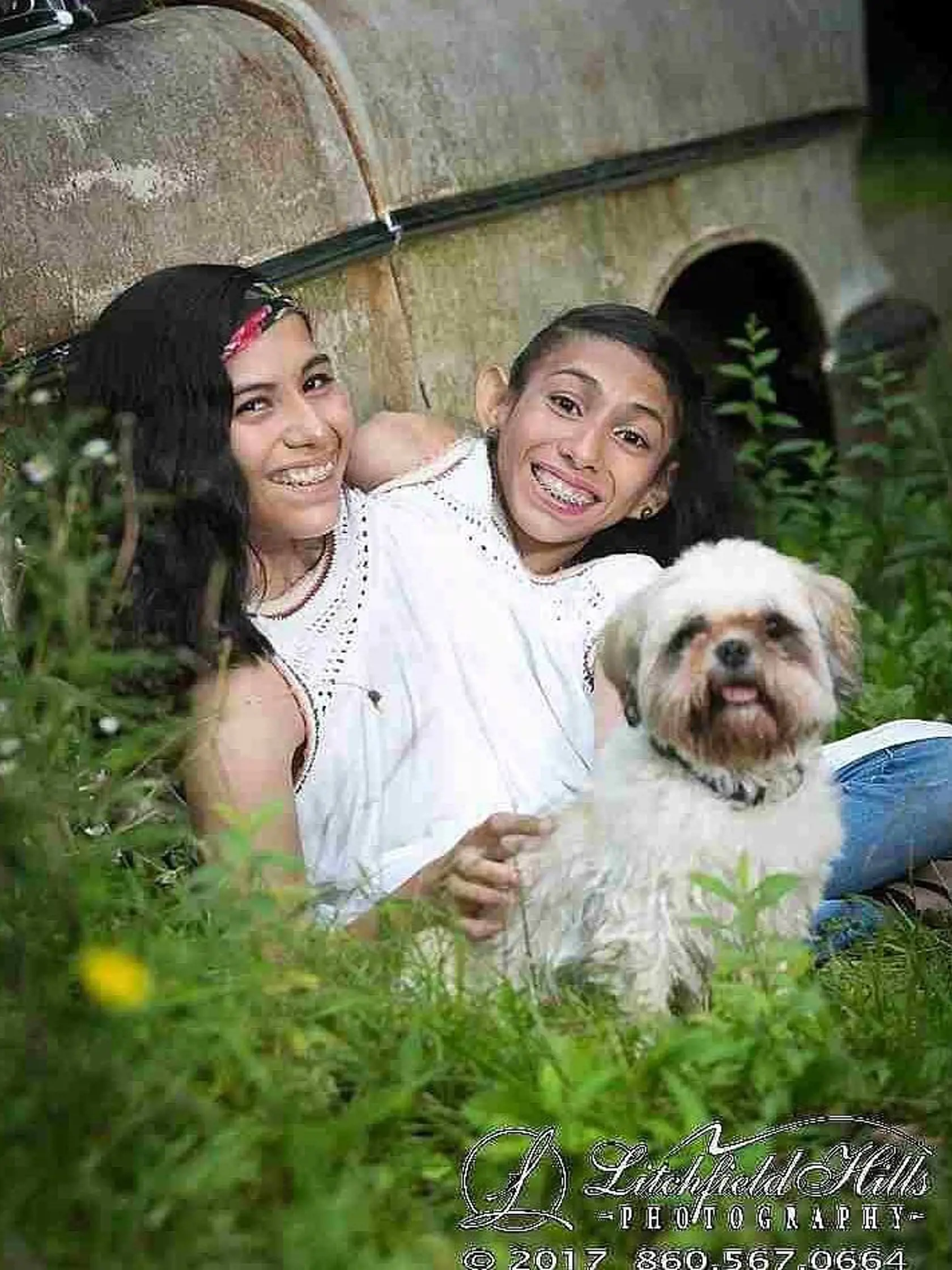 Carmen a Lupita Andrade (23) sú siamské dvojčatá, ktoré žijú v Connecticute.