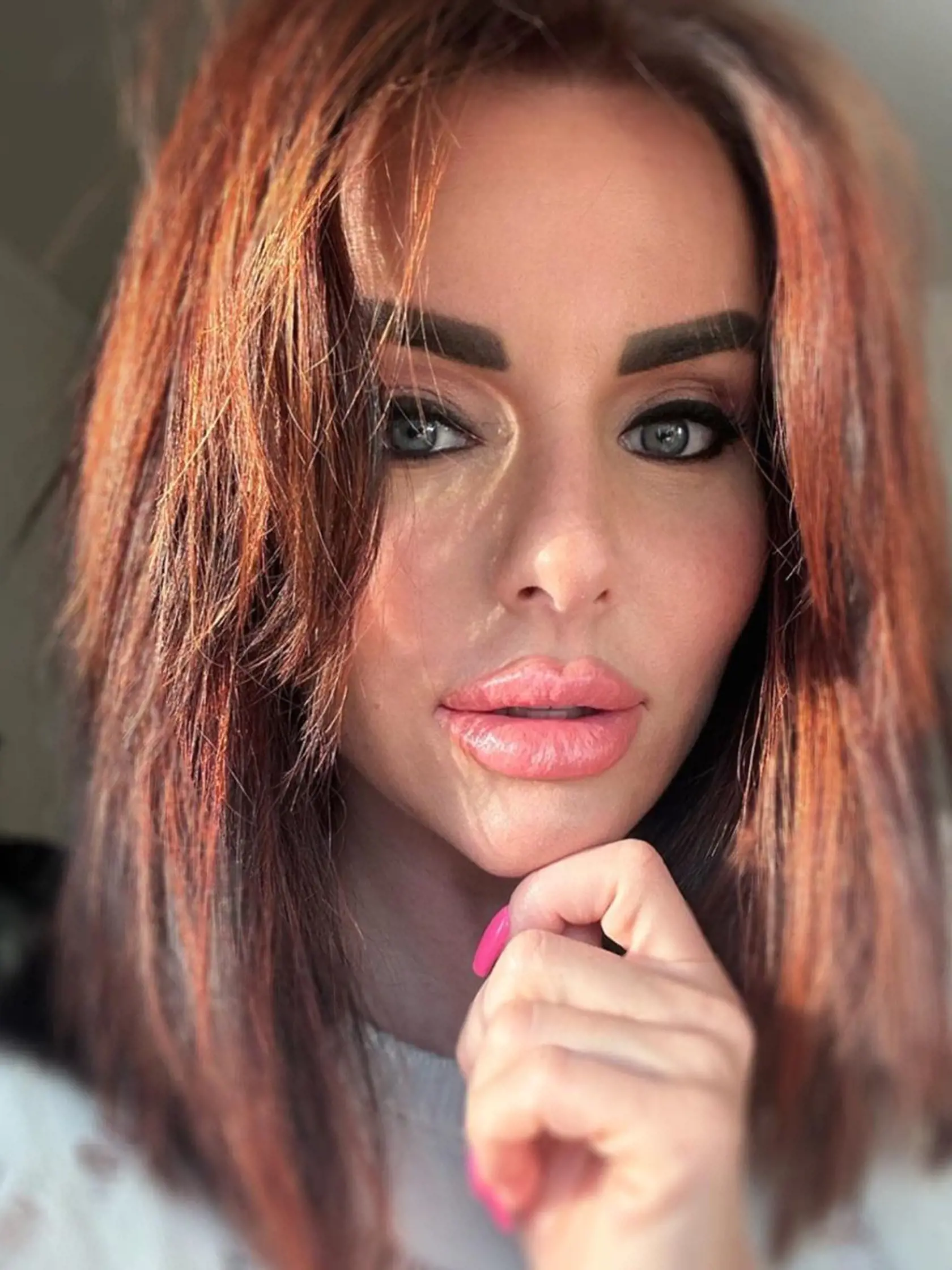 Julia Volkova to s plastikami už prehnala. Z toho nežného uličníckeho dievčaťa nič nezostalo.