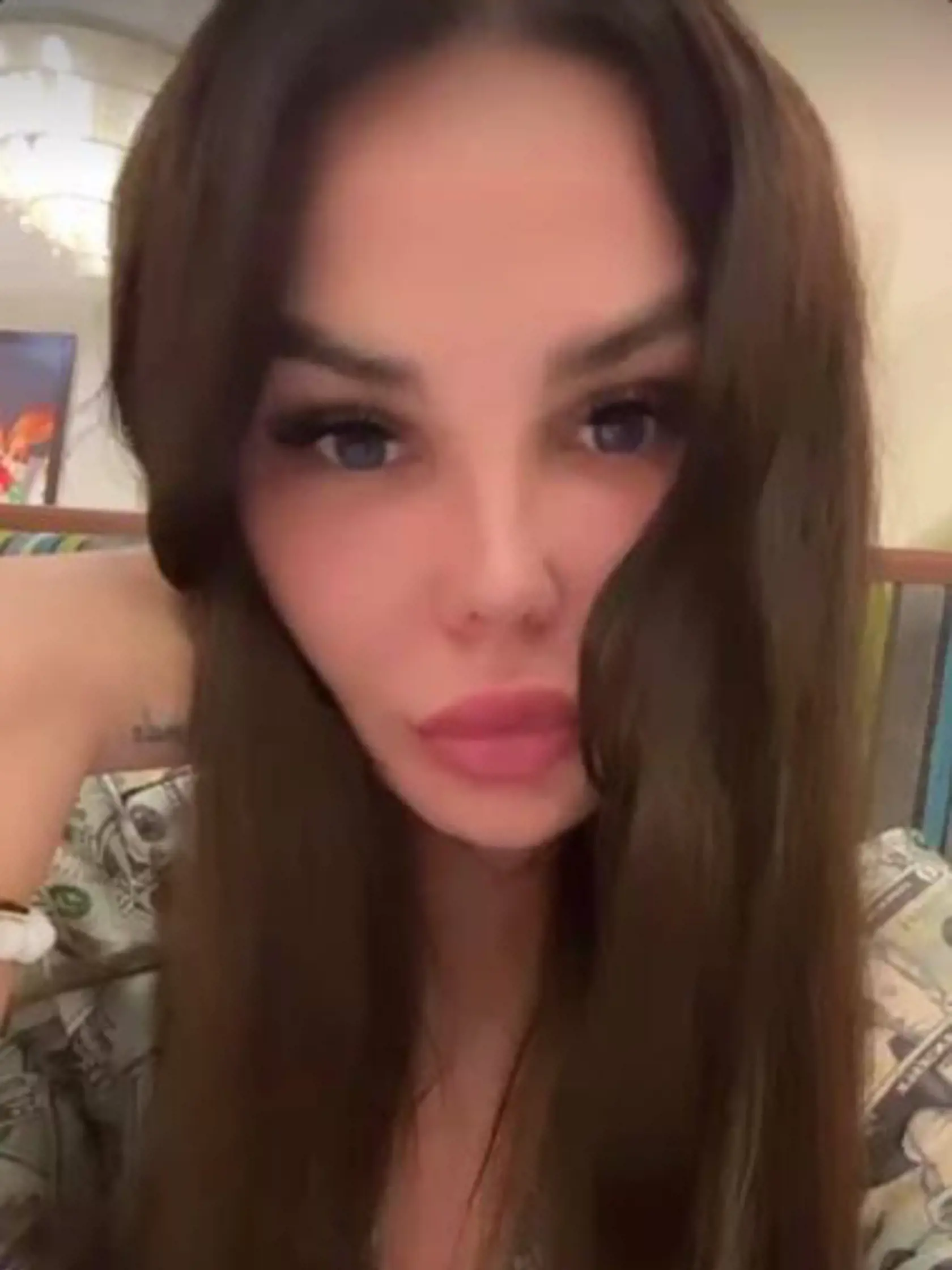 Aj keď za plastiku tváre vysolila 33-tisíc eur, Plačková musí neustále používať skrášľovacie filtre.