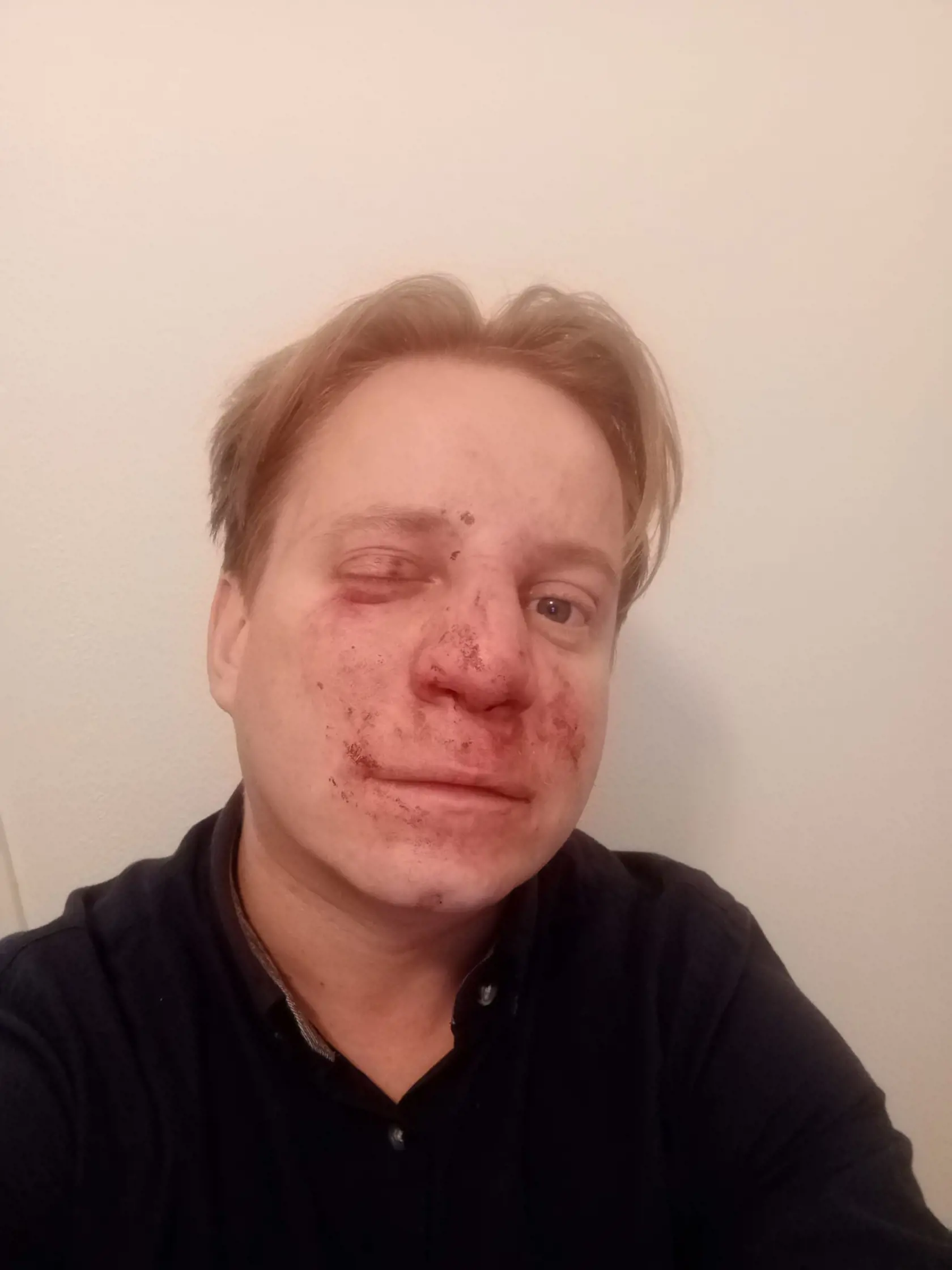 Herec Ivan Pavel Kozák zverejnil fotku po tom, ako ho dobili takmer na smrť.