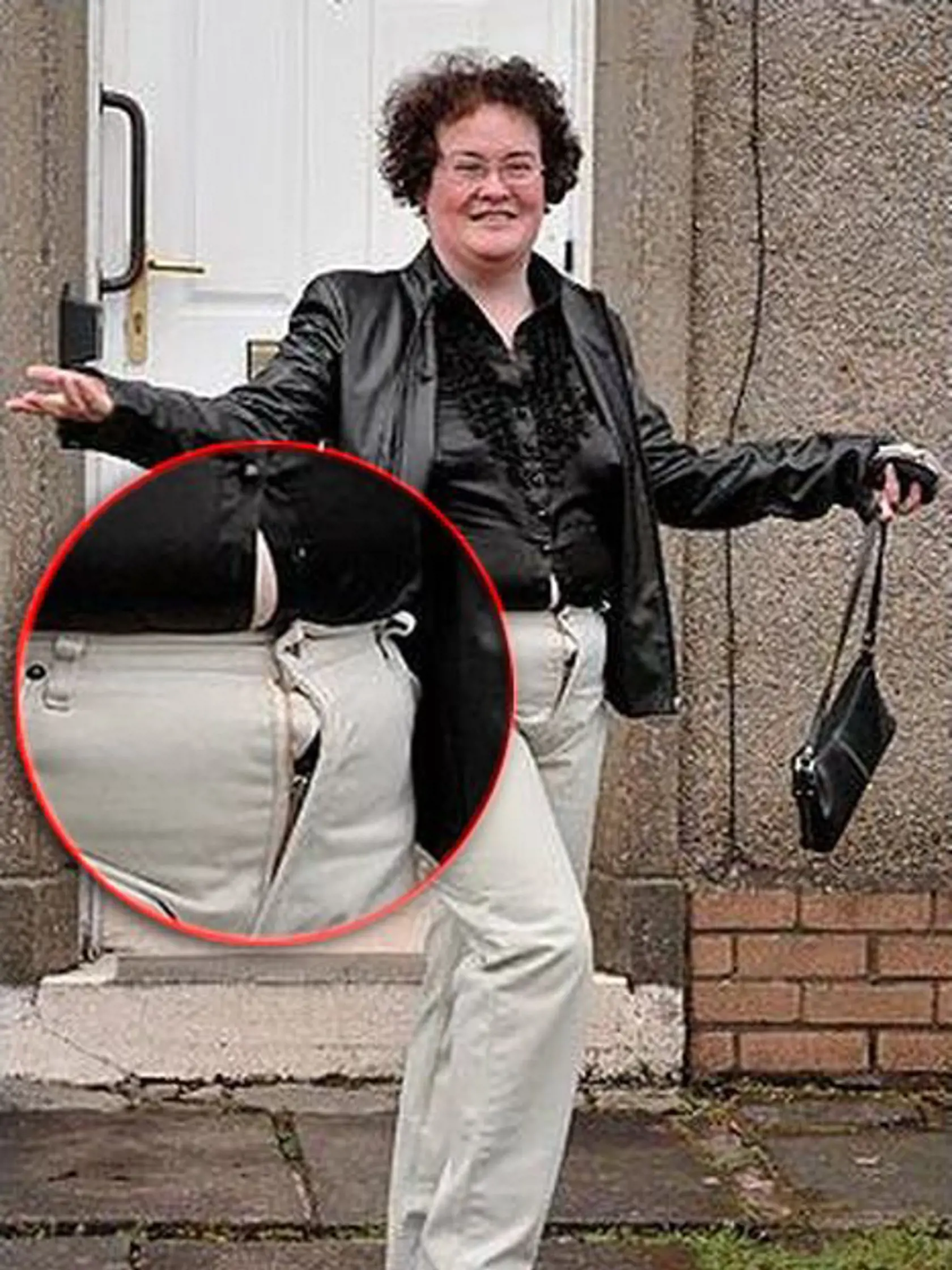 Susan Boyle doplatila pri fotení na príliš tesné
