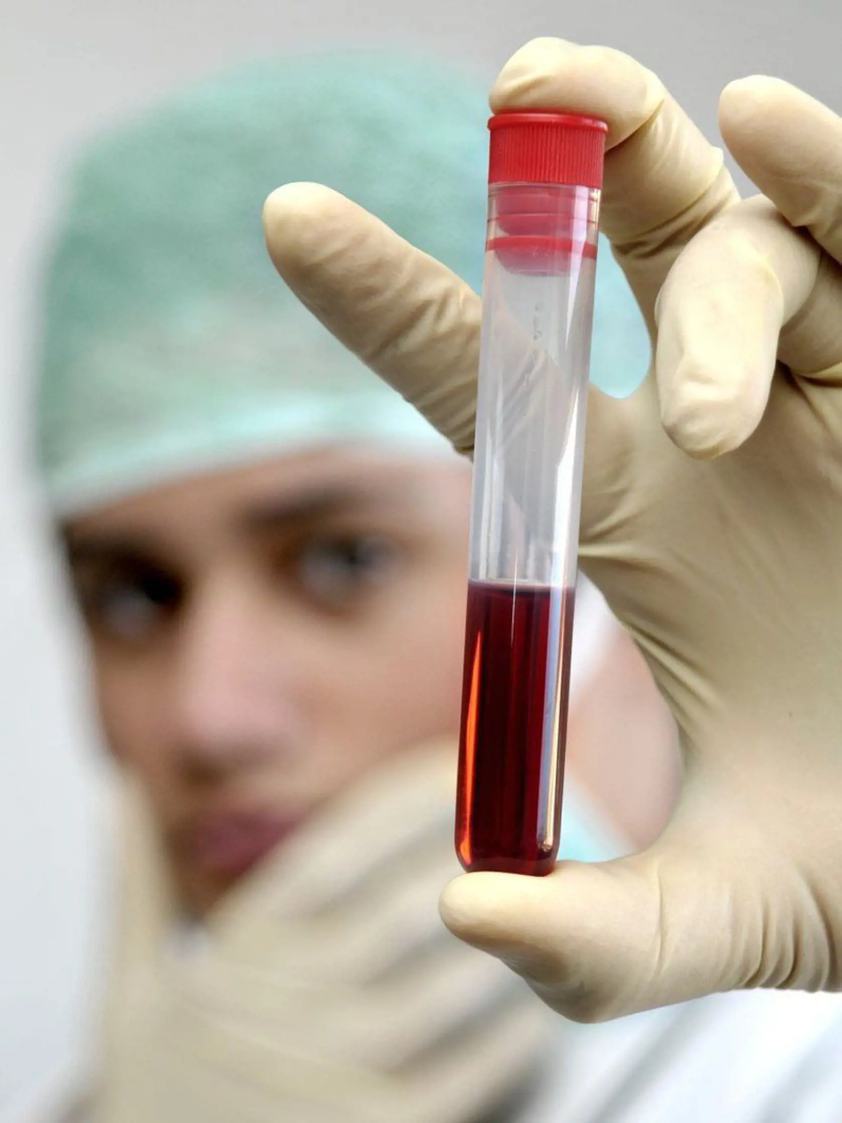 Borelióza sa najčastejšie zisťuje krvnými testami.