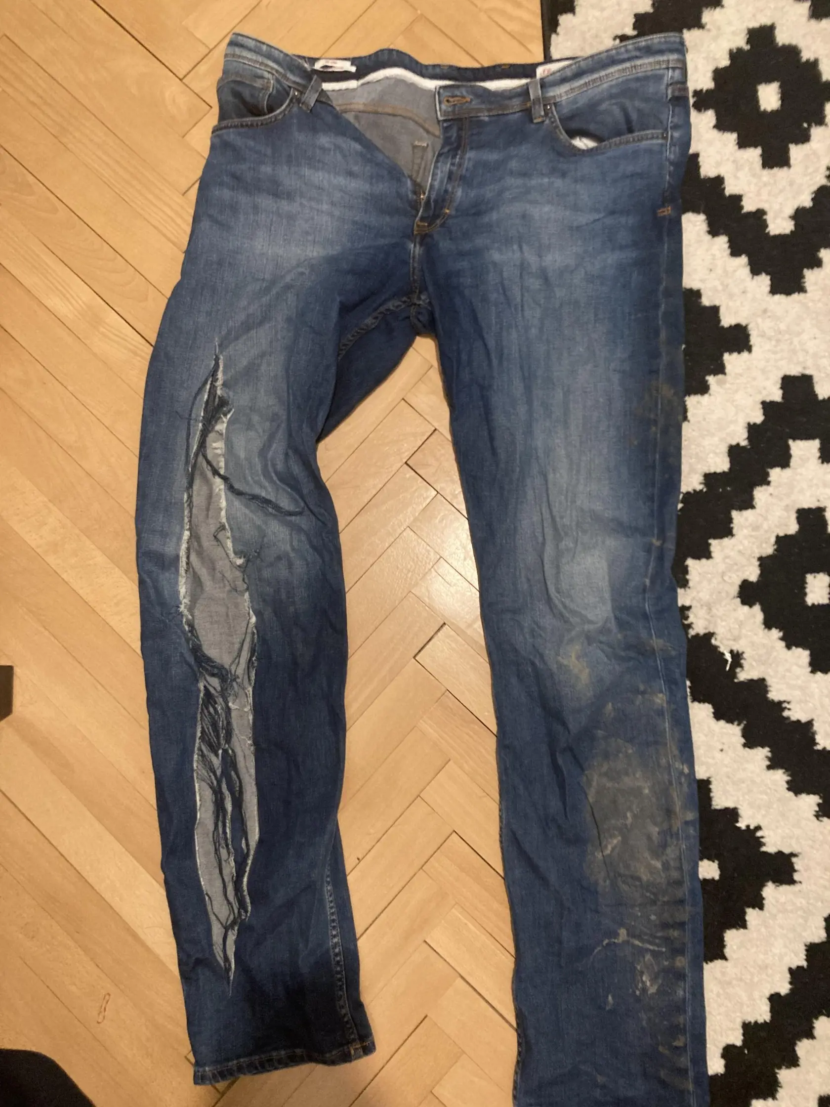 Zranenia pána Vlastimila po brutálnom policajnom zákroku.