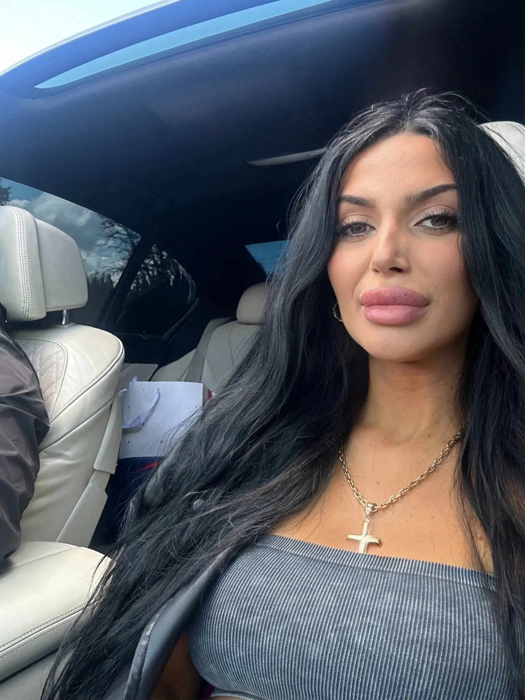 Simona Borženská mala pred niekoľkými rokmi vážnu autonehodu, má za sebou niekoľko operácií.